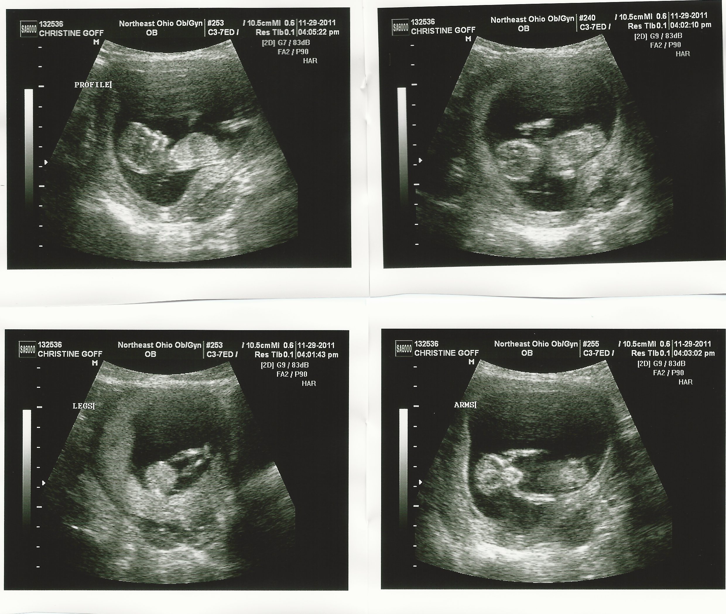 Alien ultrasound photo