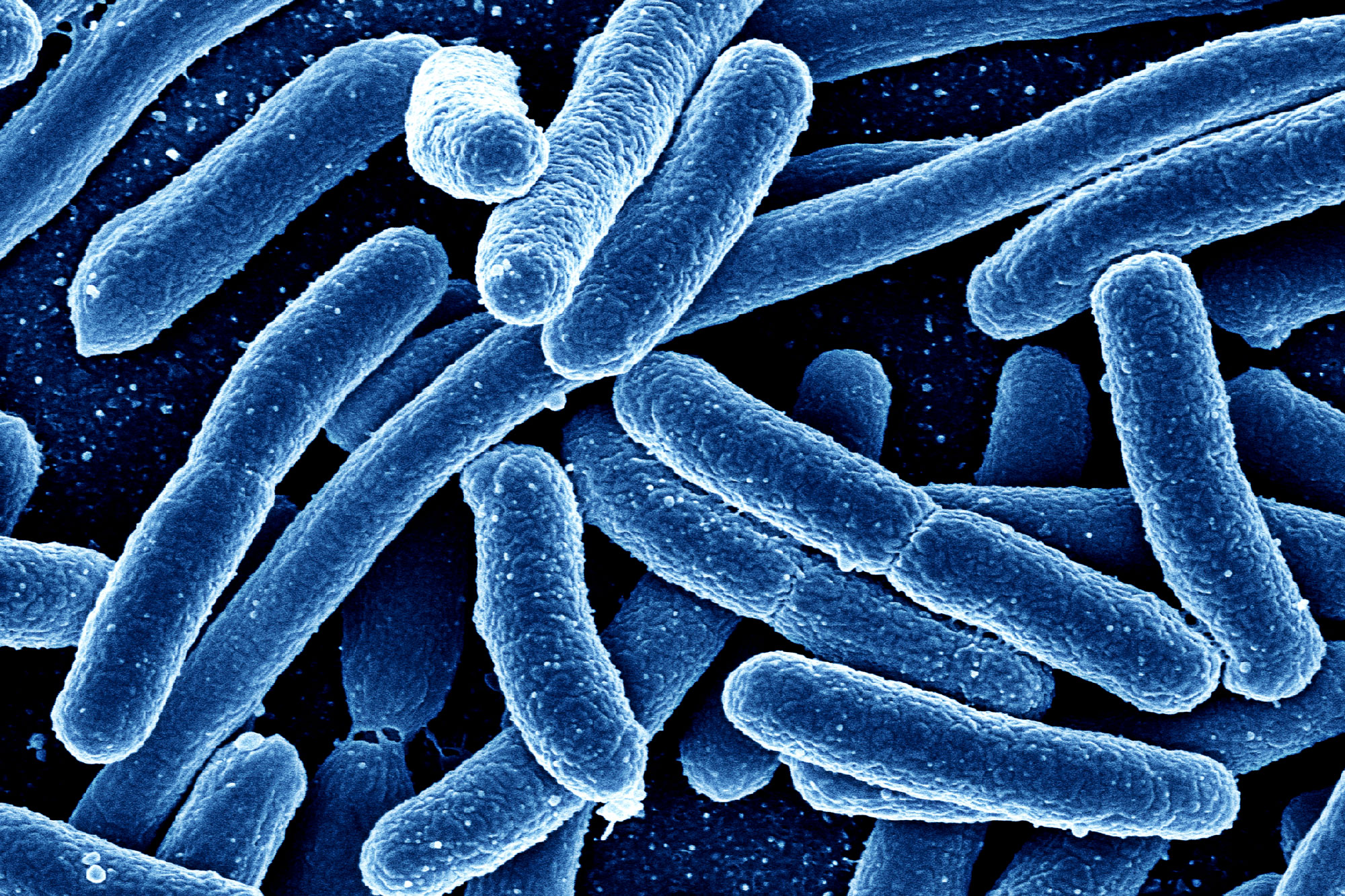 Caltech breakthrough: Bacteria engineered with 'sonar' fight disease