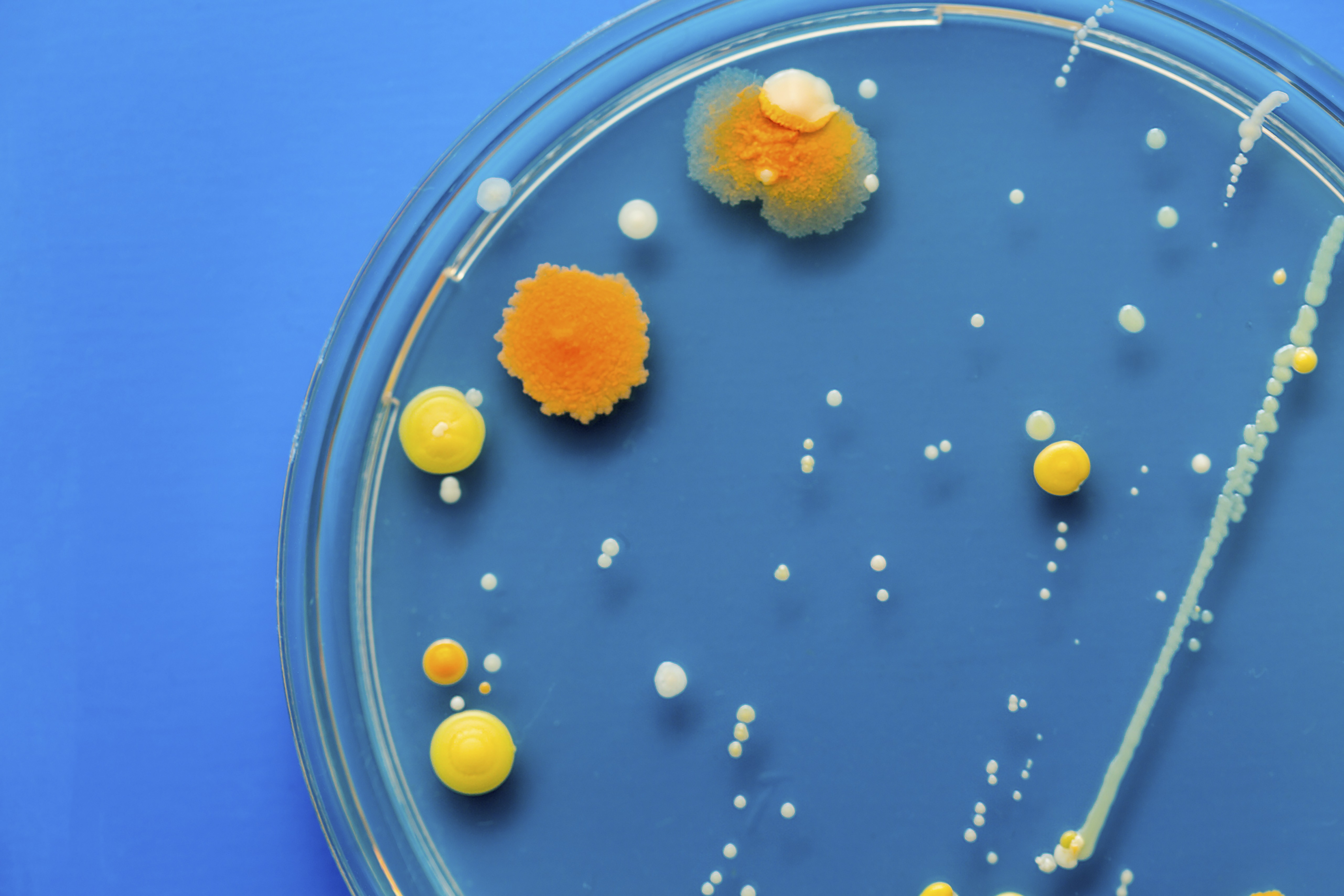 CDC Finds 'Nightmare Bacteria' Across the U.S. | Time