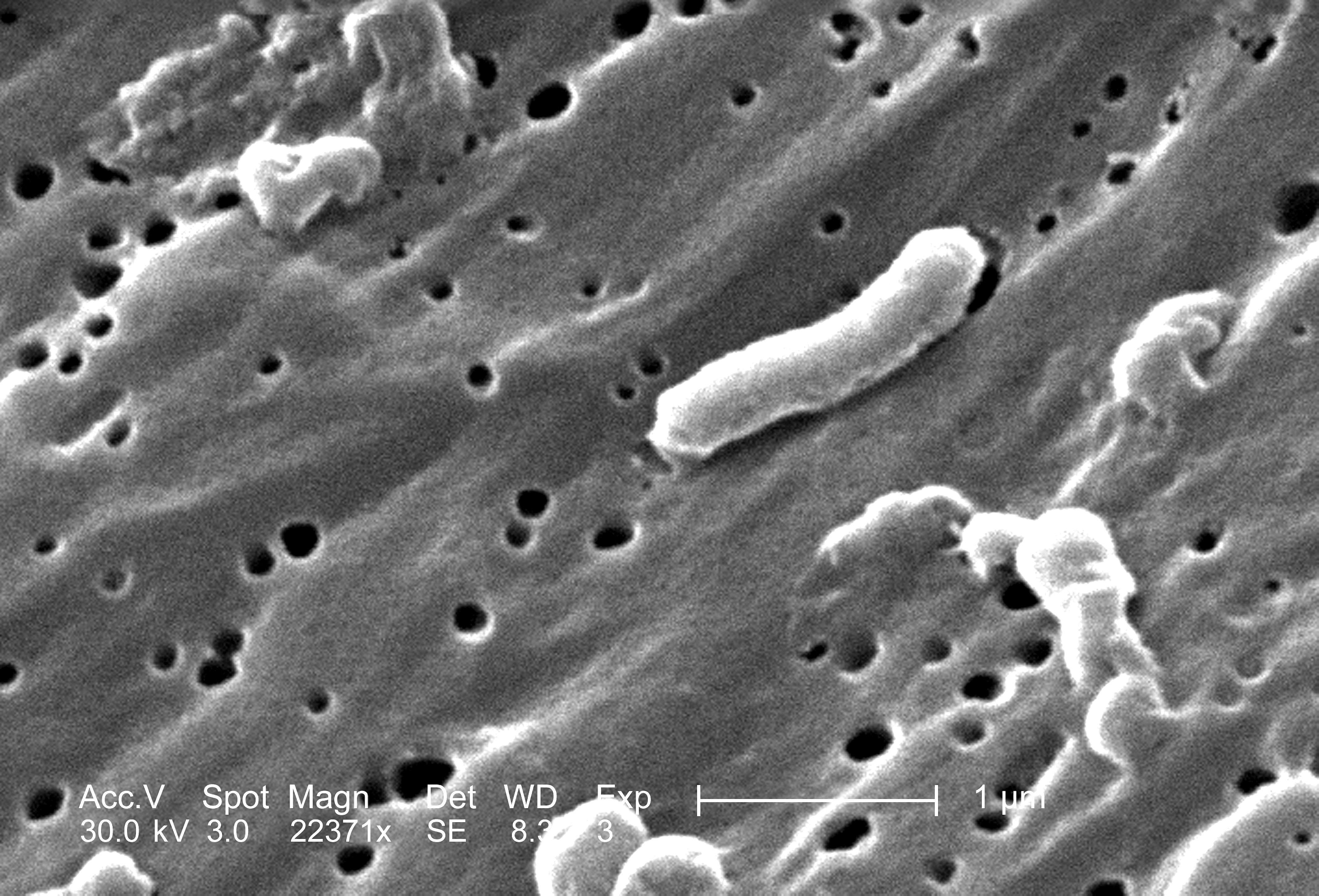Free picture: vibrio cholerae, bacteria, electron micrograph