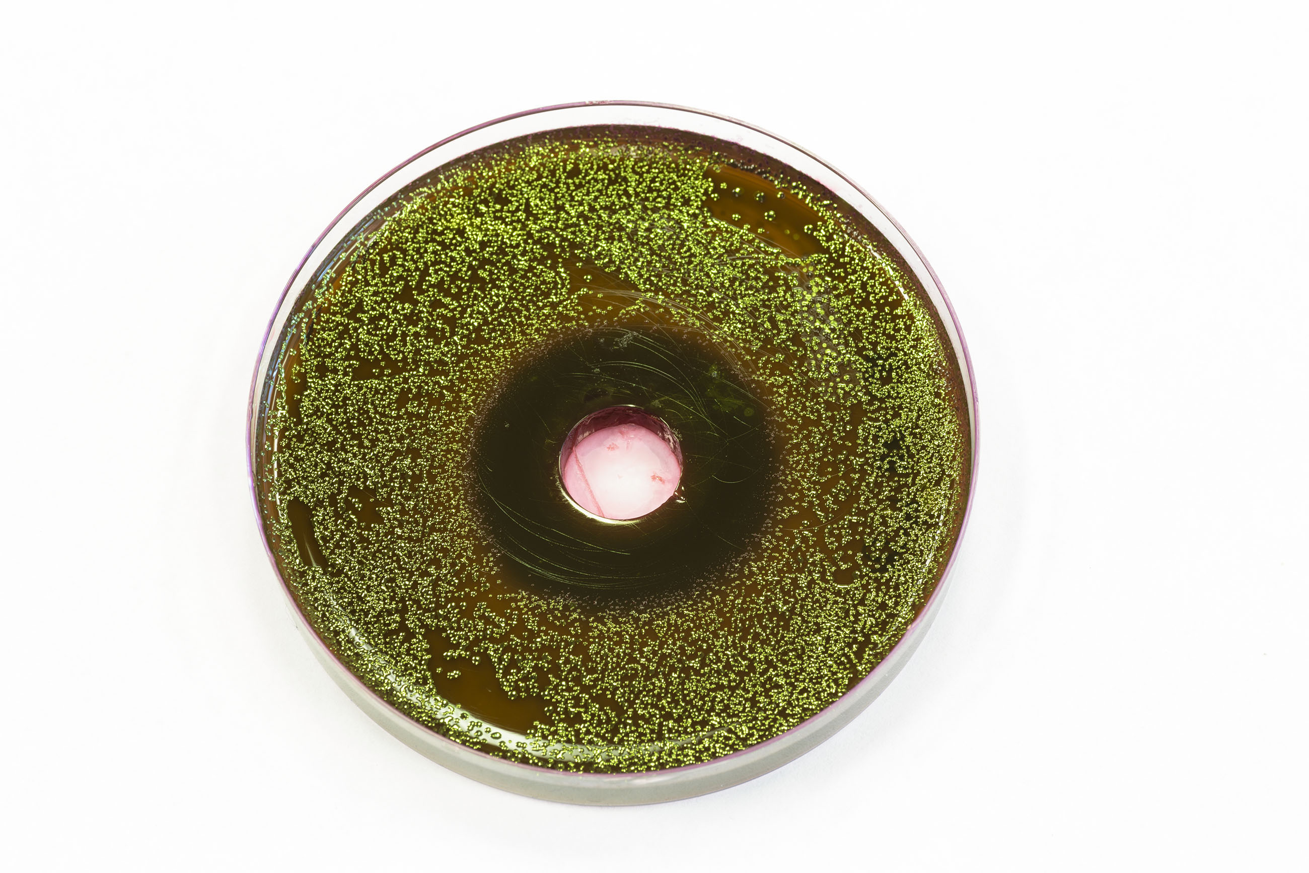 Bacteria growing on emb agar photo