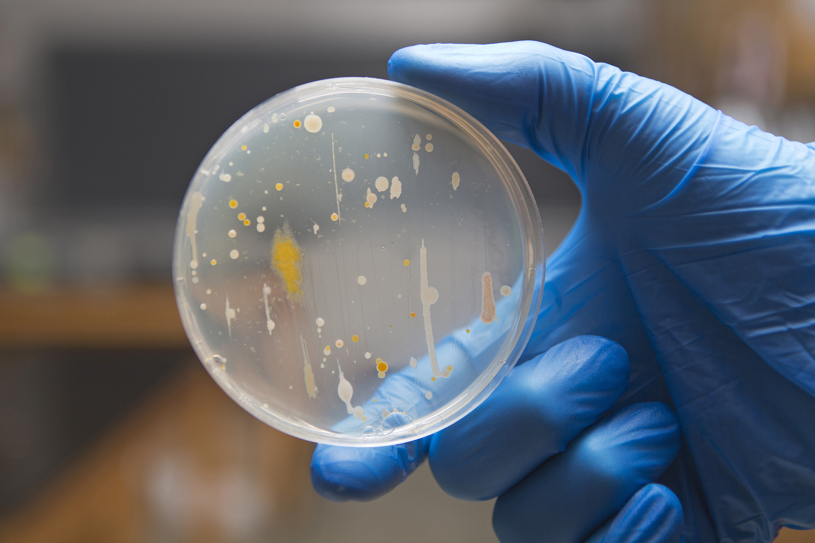 Bacteria on an agar plate photo