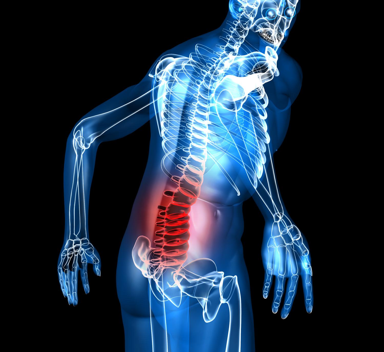 Placebo and valium are equally effective for acute lower back pain ...