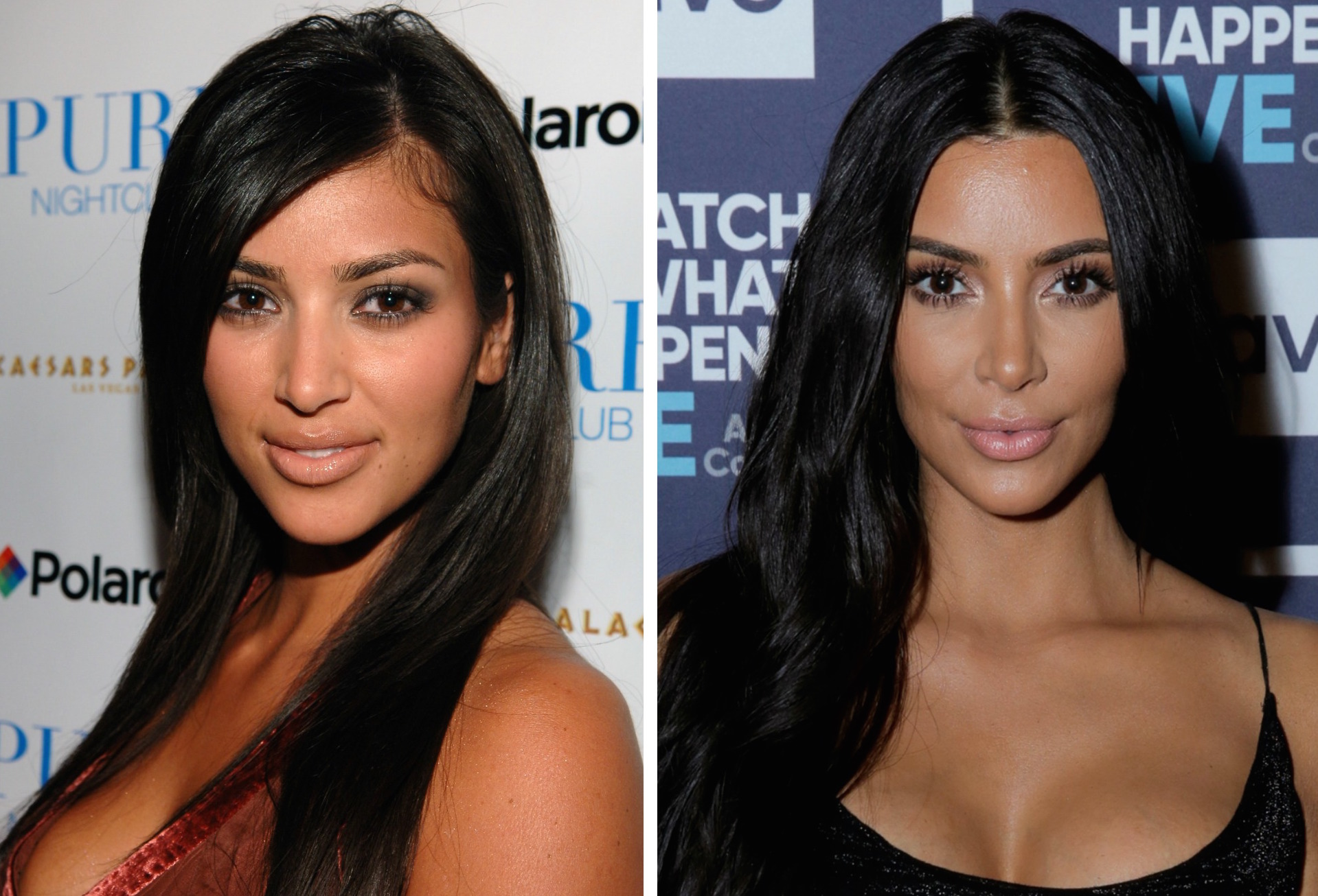 Kardashian Sisters: Who's Gotten the Most Surgery? - Life & Style