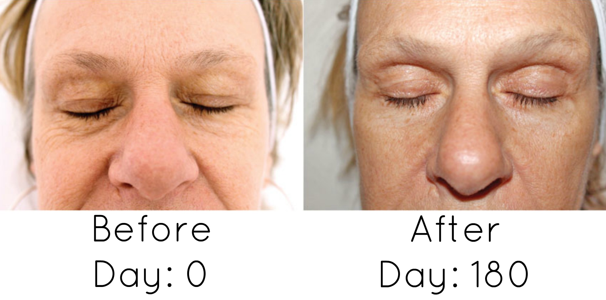 Before & After - Categories - Osmosis Skin Care Products