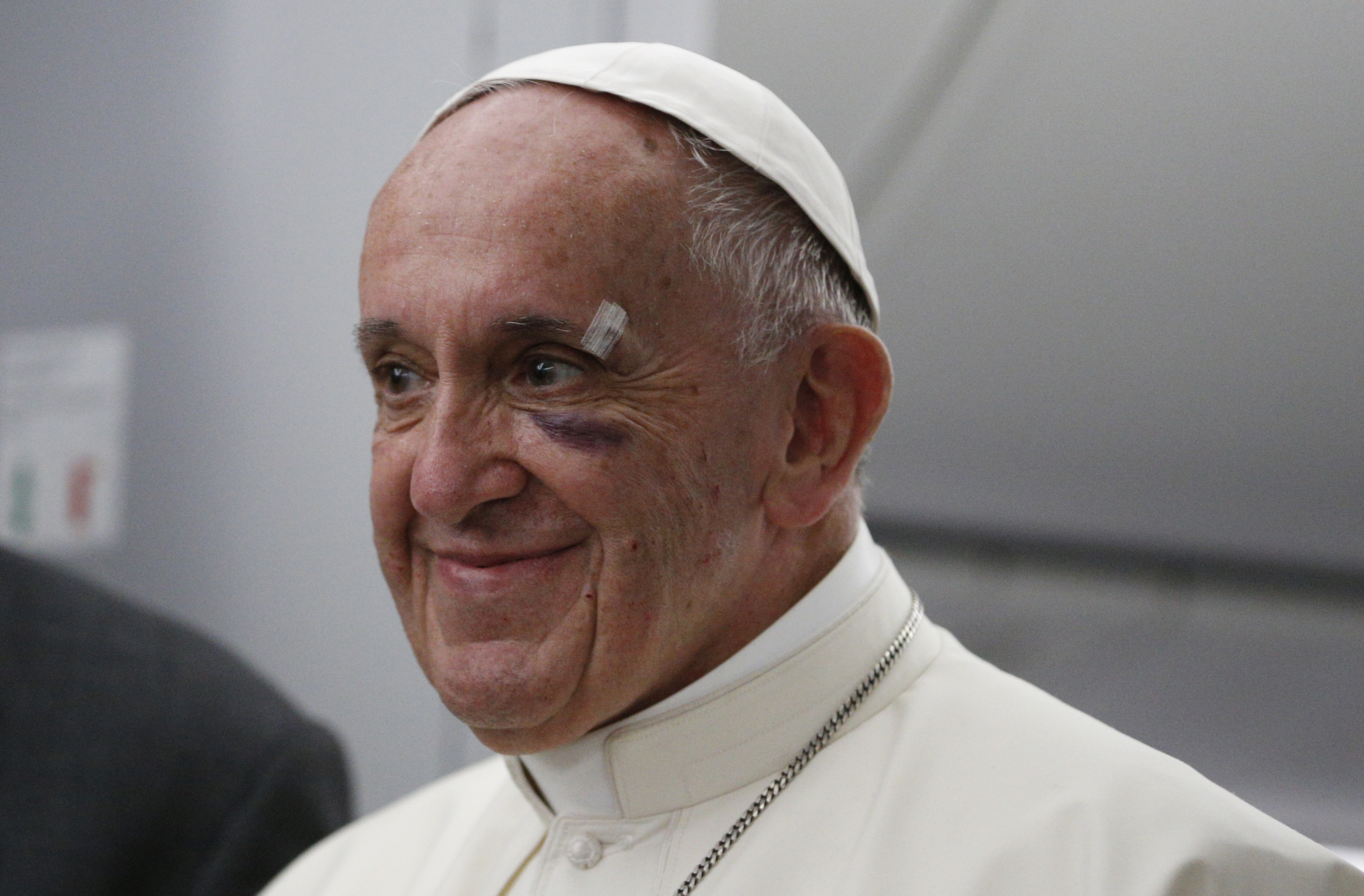 Pope Francis' black eye tells us a lot about the church today ...