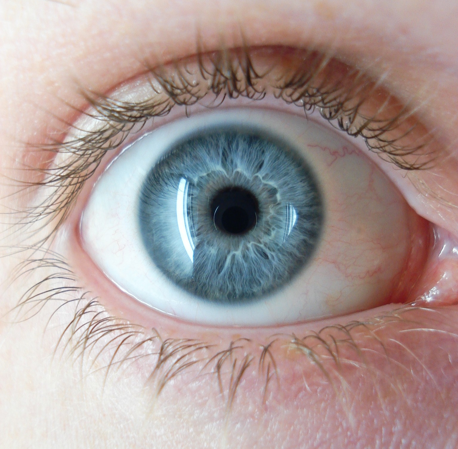 File:A blue eye.jpg - Wikimedia Commons