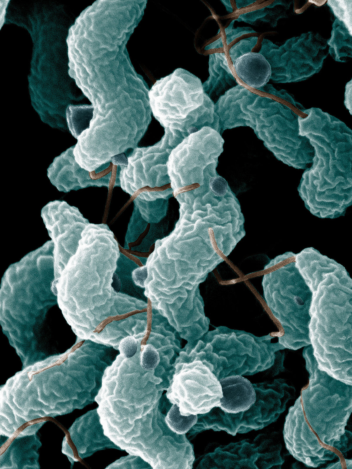 Campylobacter - Wikipedia