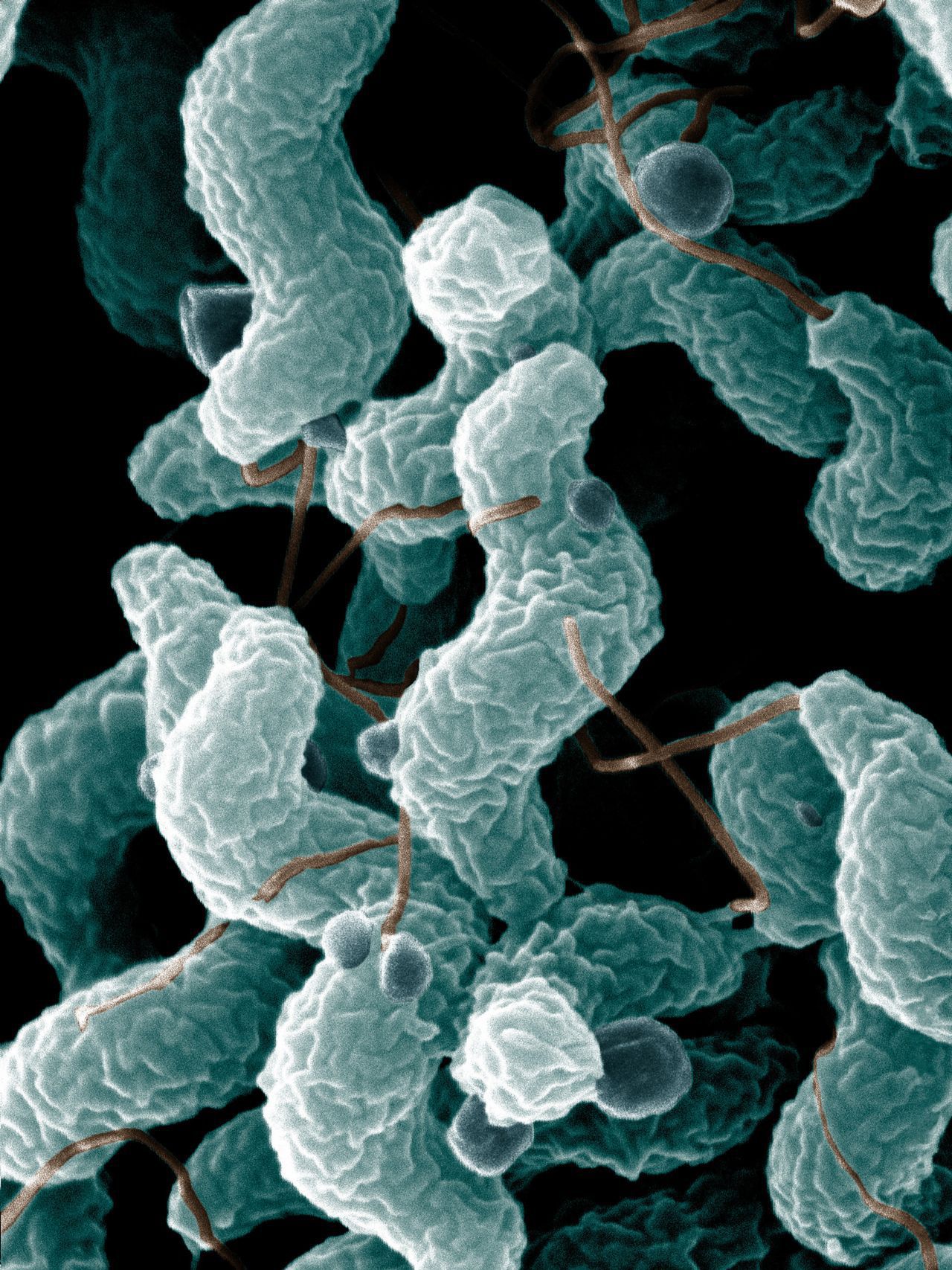 Michigan Campylobacter Bacteria Food Poisoning Lawyer