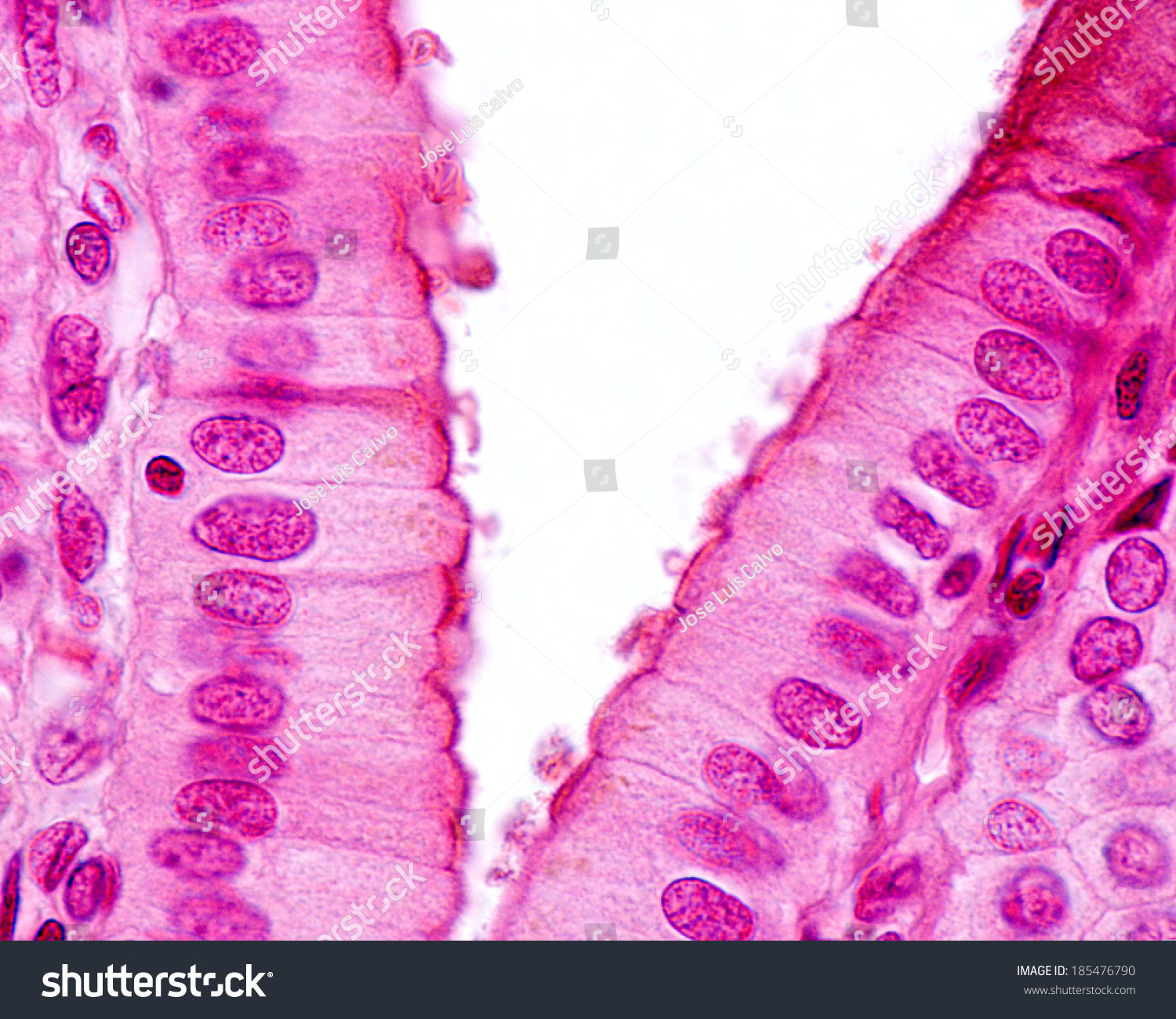 Light Micrograph Showing Simple Columnar Epithelium Stock Photo ...