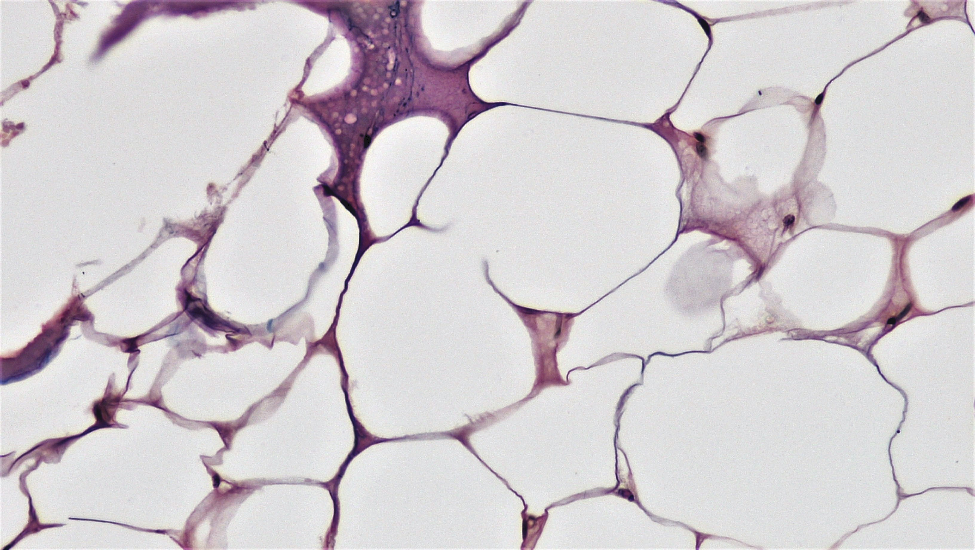 Connective Tissue: Adipose, Animal, Cross, Fat, Histology, HQ Photo