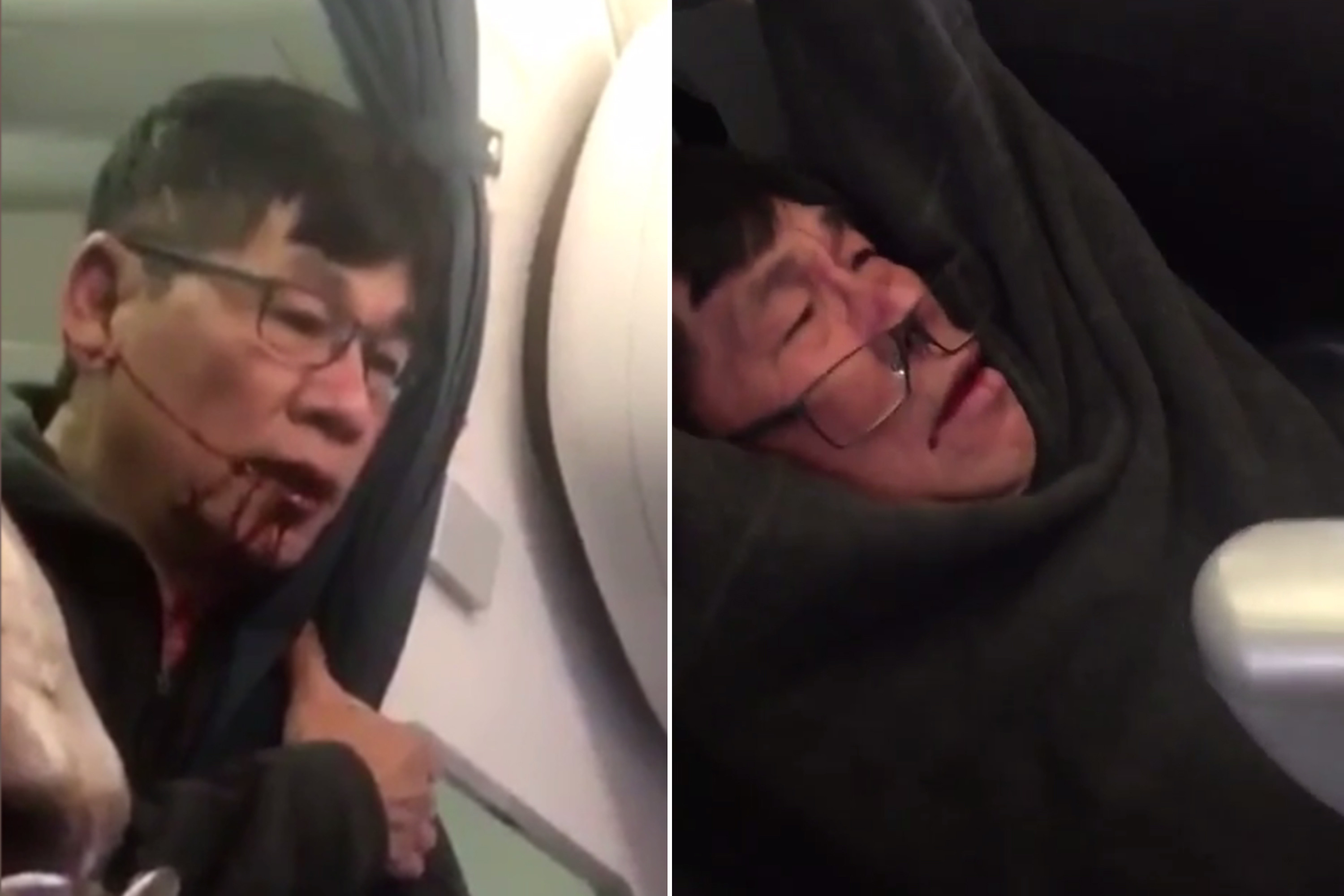 Doctor dragged off flight was convicted of trading drugs for sex