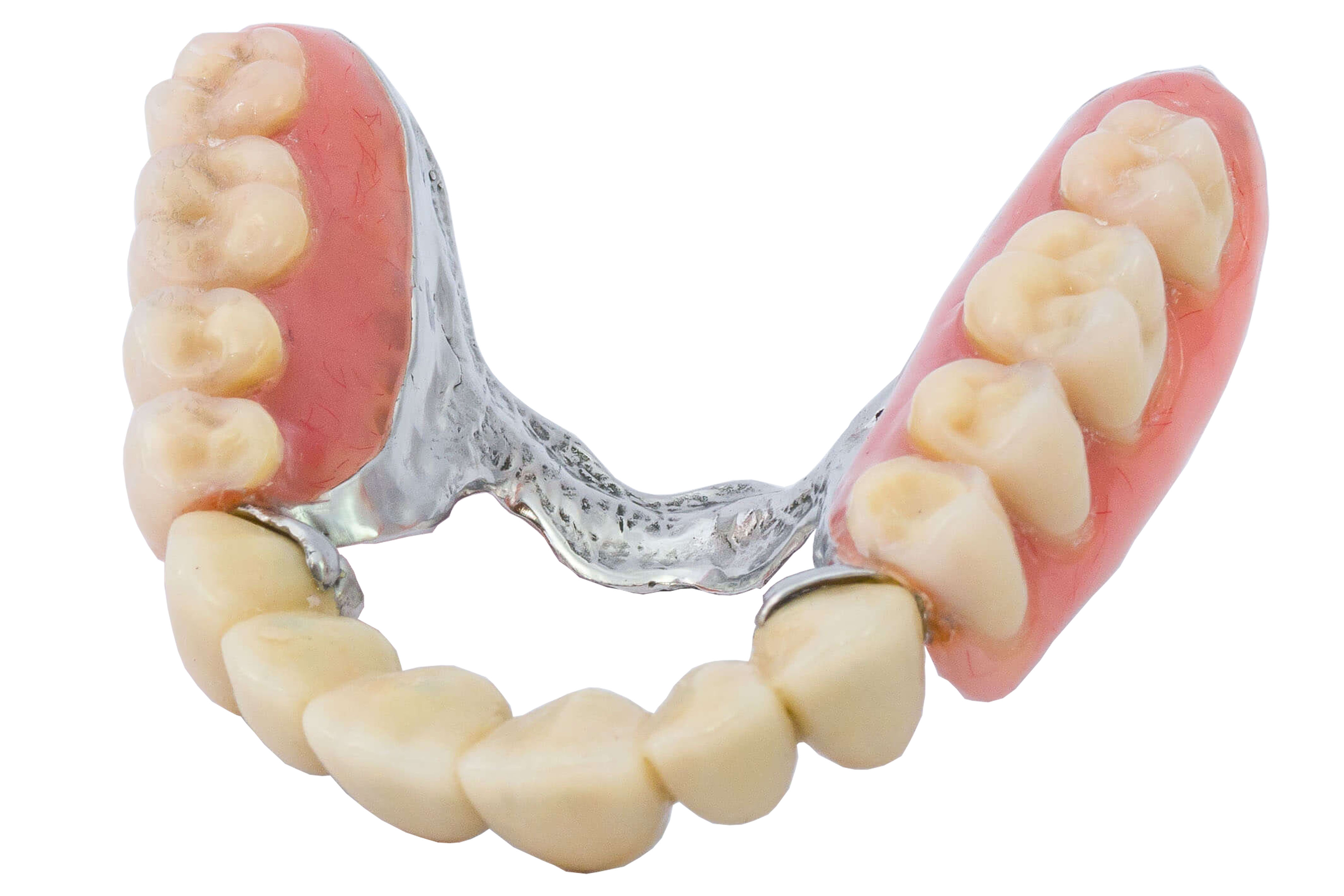 Combined dental prostheses - Kalmar