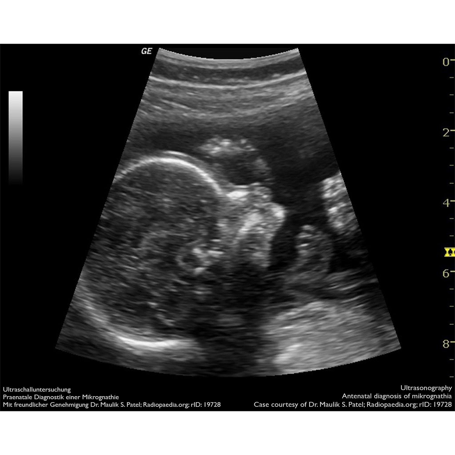 Ultraschall [Ultrasonography] | Bildgebung – Imaging | Pinterest ...