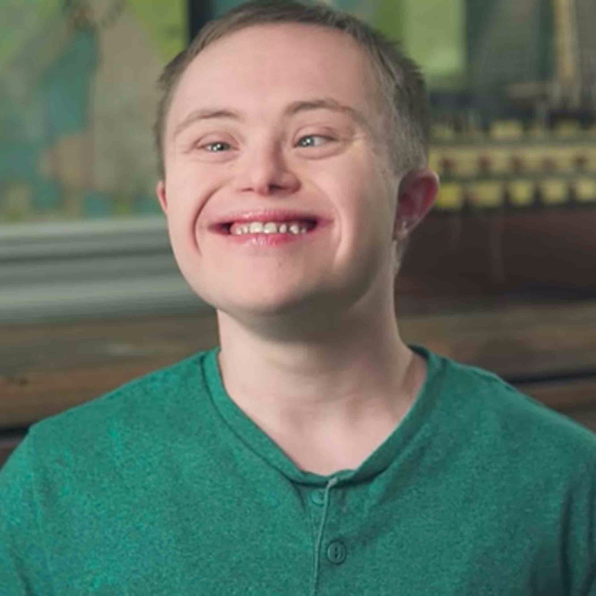 Down Syndrome Photos — Superepus News