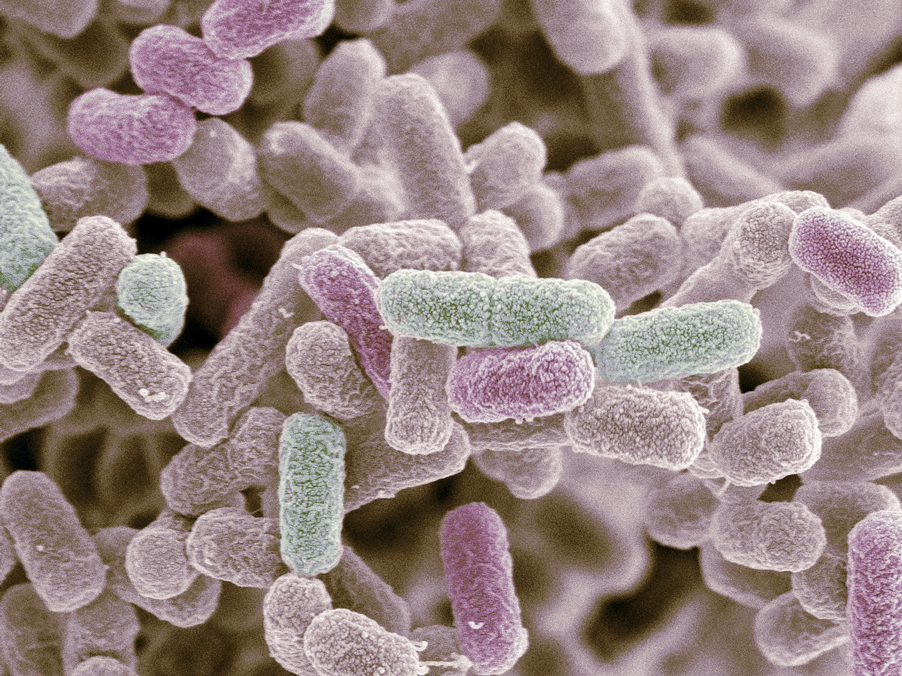 Free Photo Escherichia Coli Analysis Microbial Inspection Free 