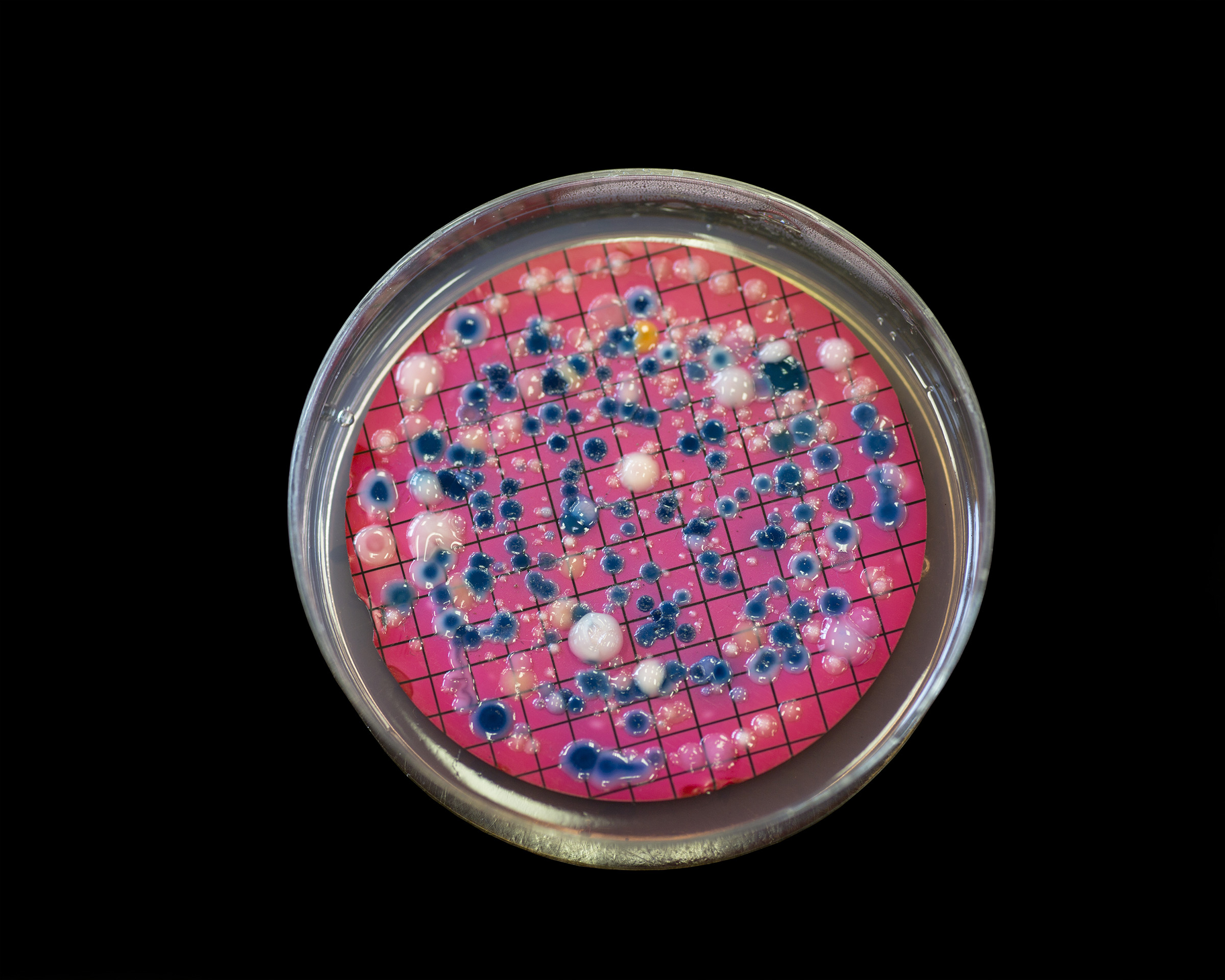 Escherichia coli colonies photo