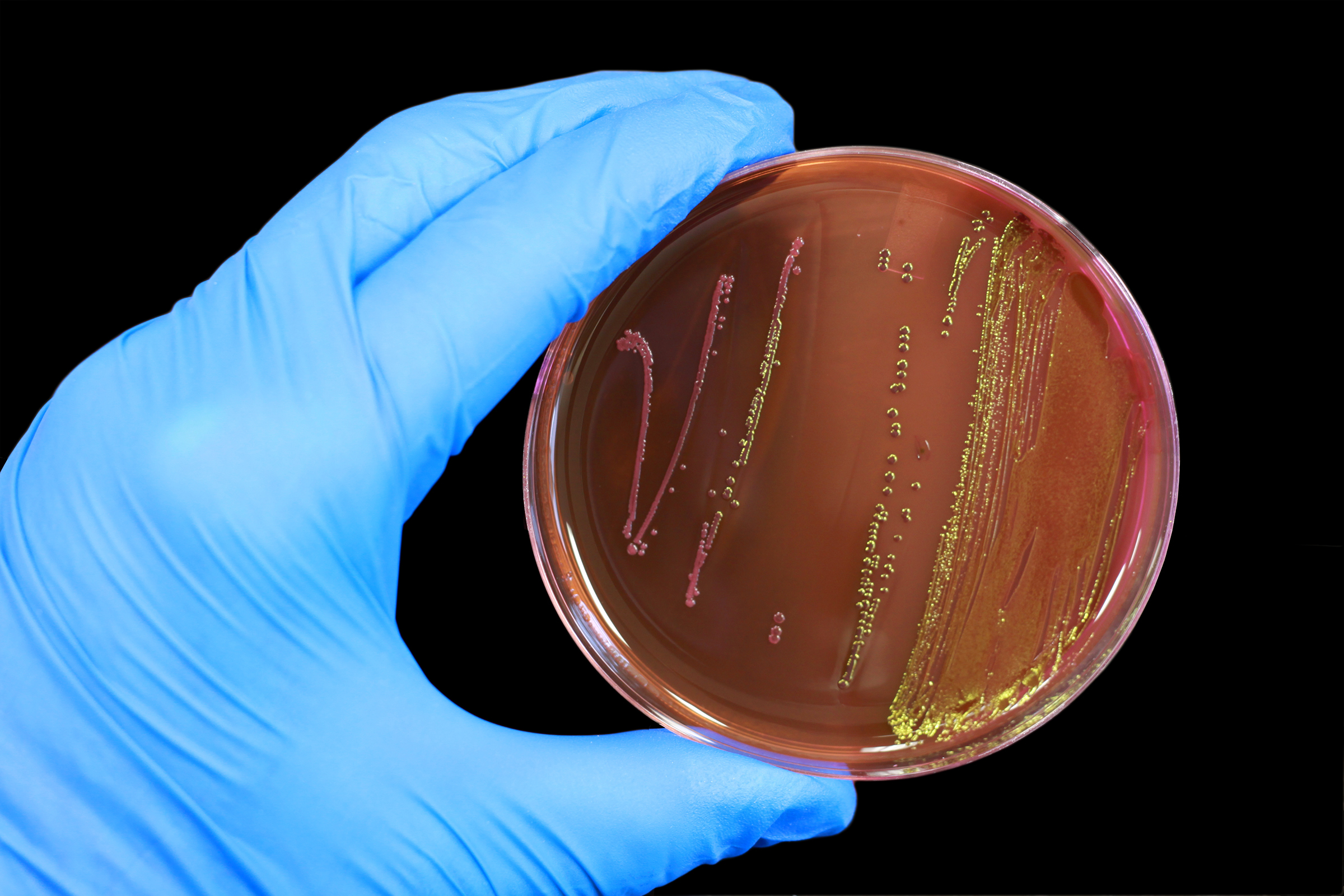 Escherichia coli, Analysis, Microbial, Inspection, Lab, HQ Photo