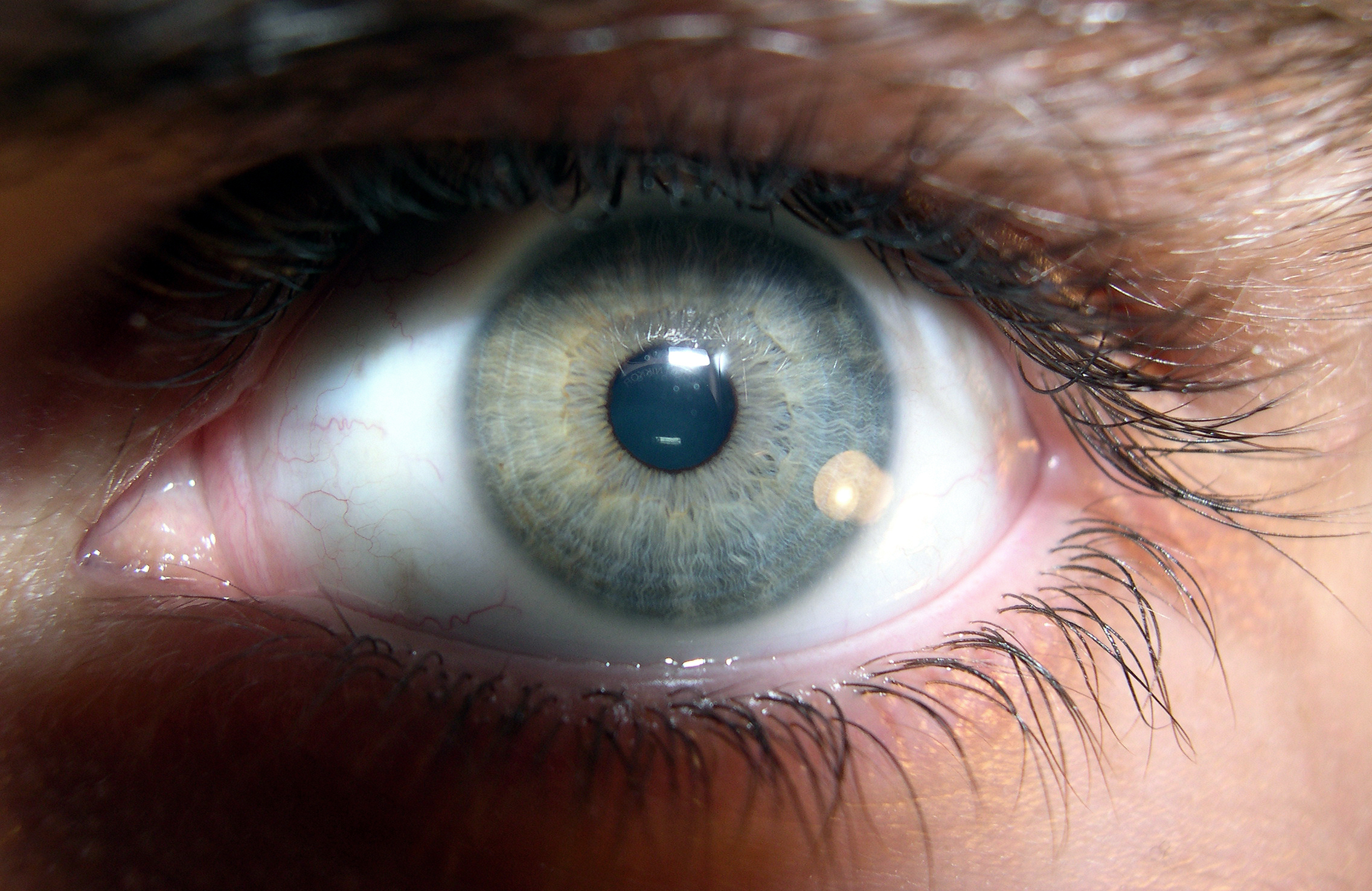 File:Brown human eye (2).jpg - Wikimedia Commons