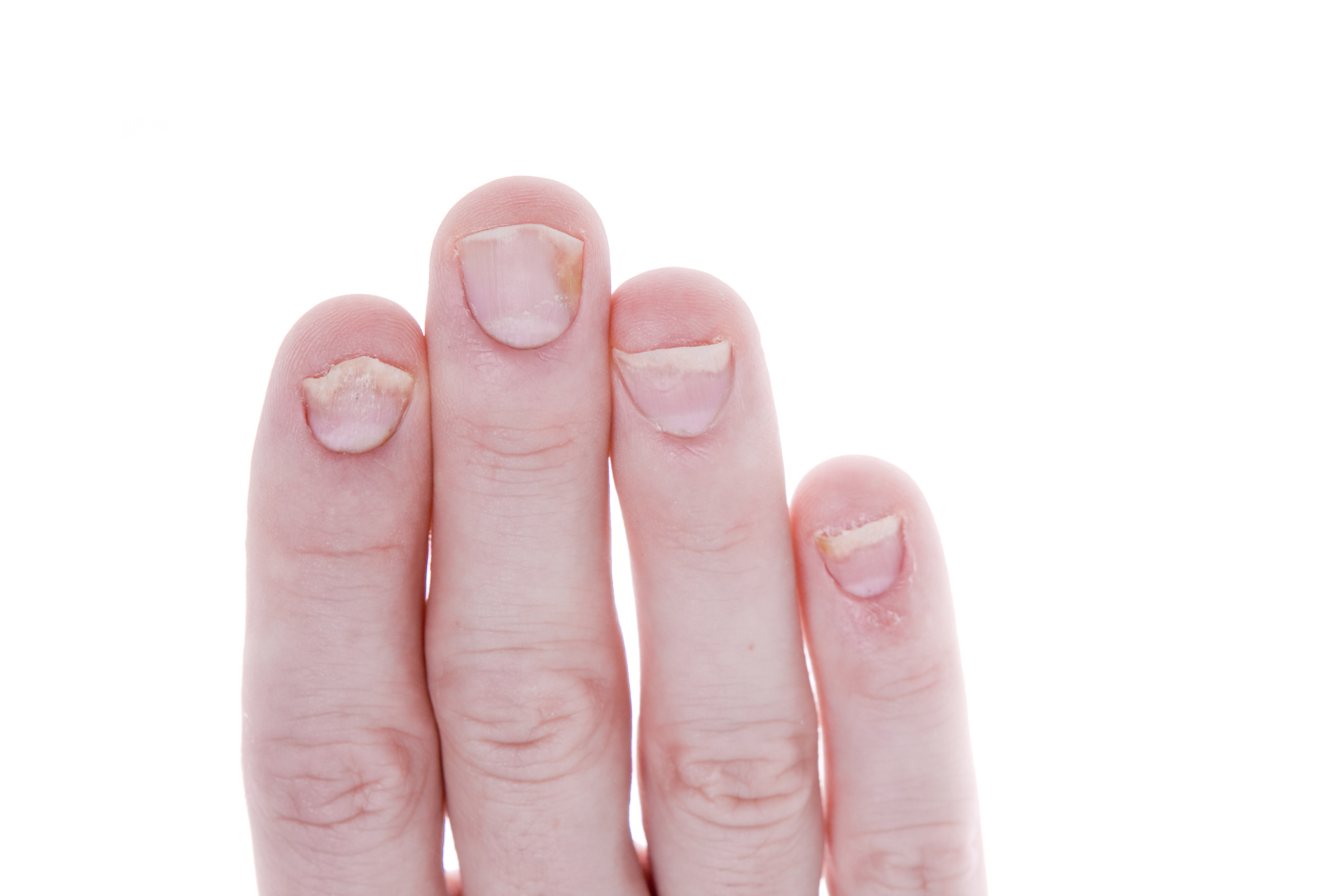Fingernails Part 1 - What Your Fingernails Say About You ...