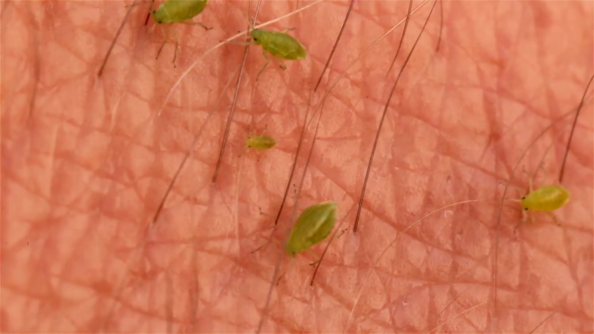 Fly larvae family crawling on human skin arm hair macro Stock Video ...