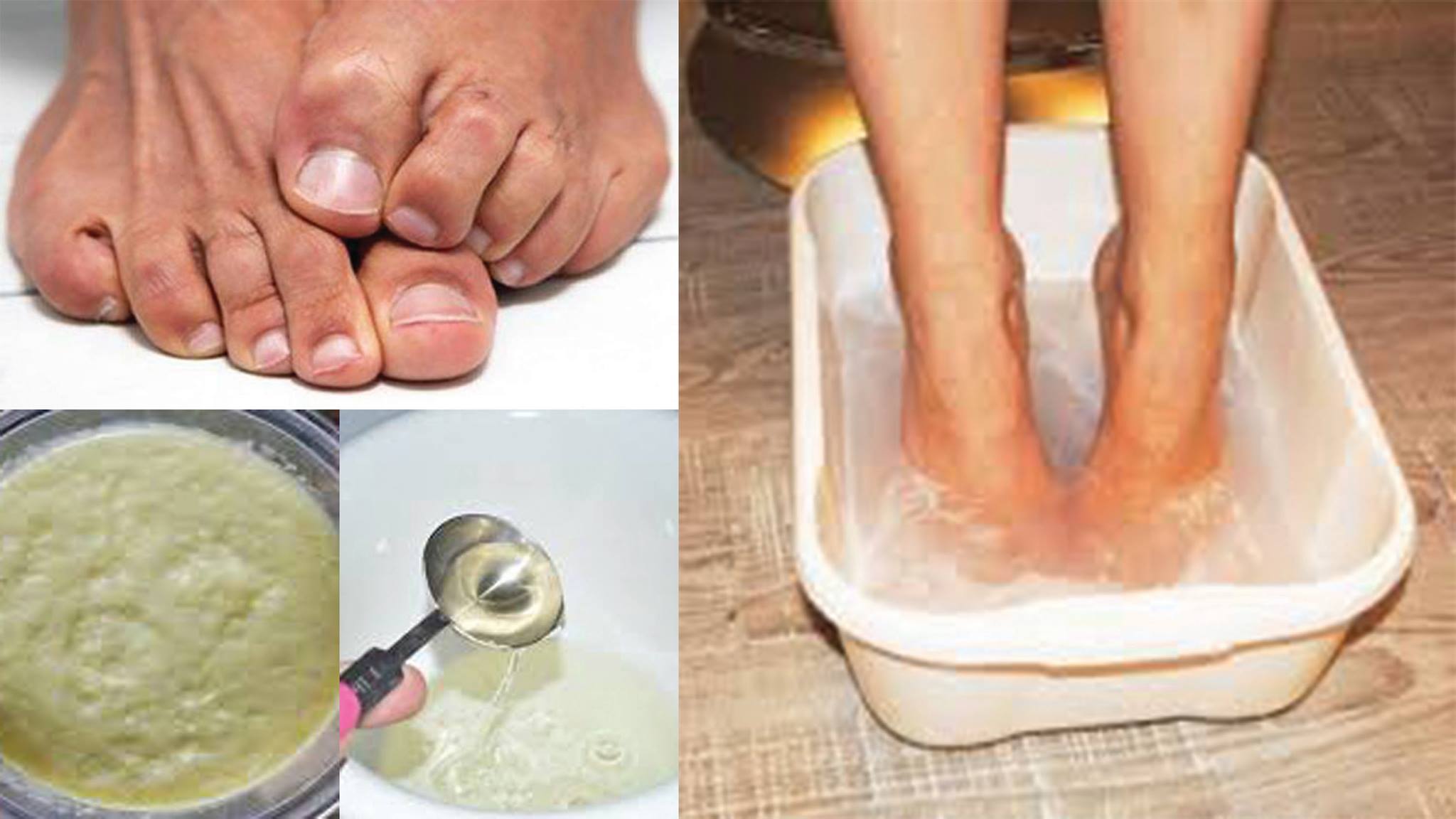 Get Rid of Foot Odor with Ginger Puree, Vinegar and Baking Soda ...