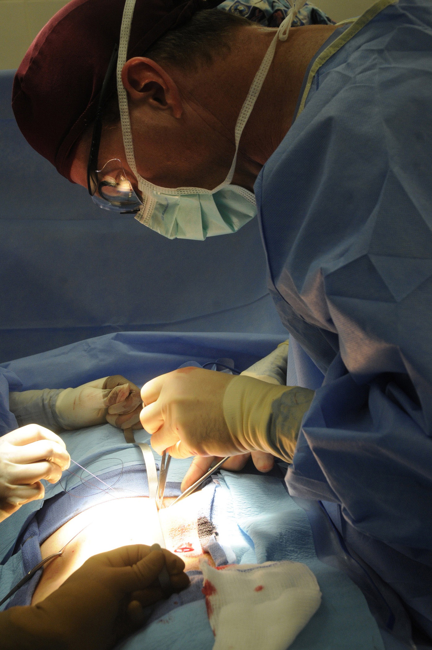 Group of surgeons operating photo