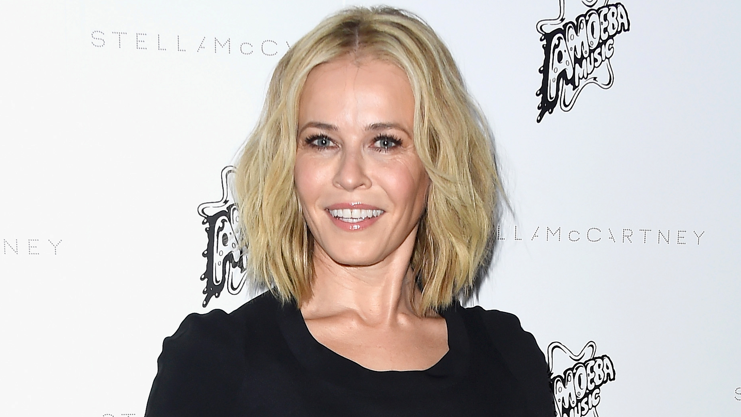 Chelsea Handler's facial treatment results stun fans, but may be ...