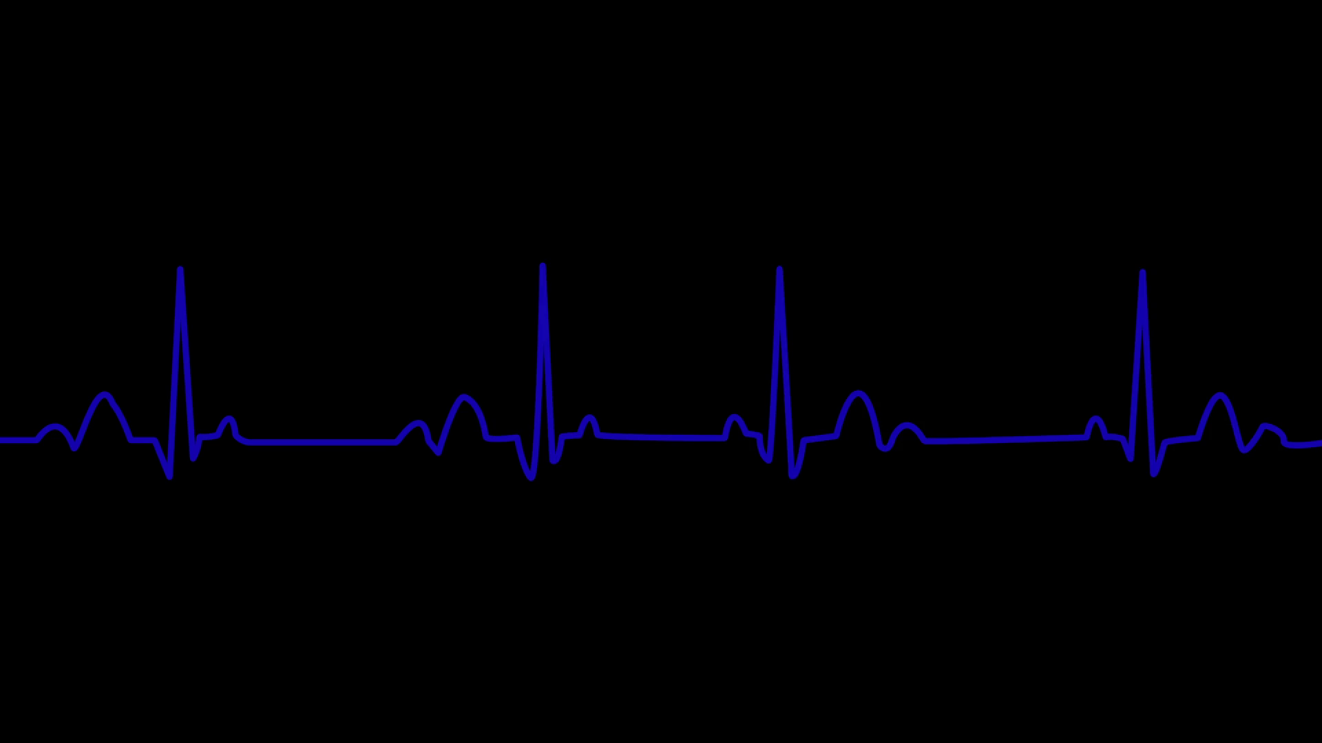Path animation of heartbeat lines on a black screen Motion ...