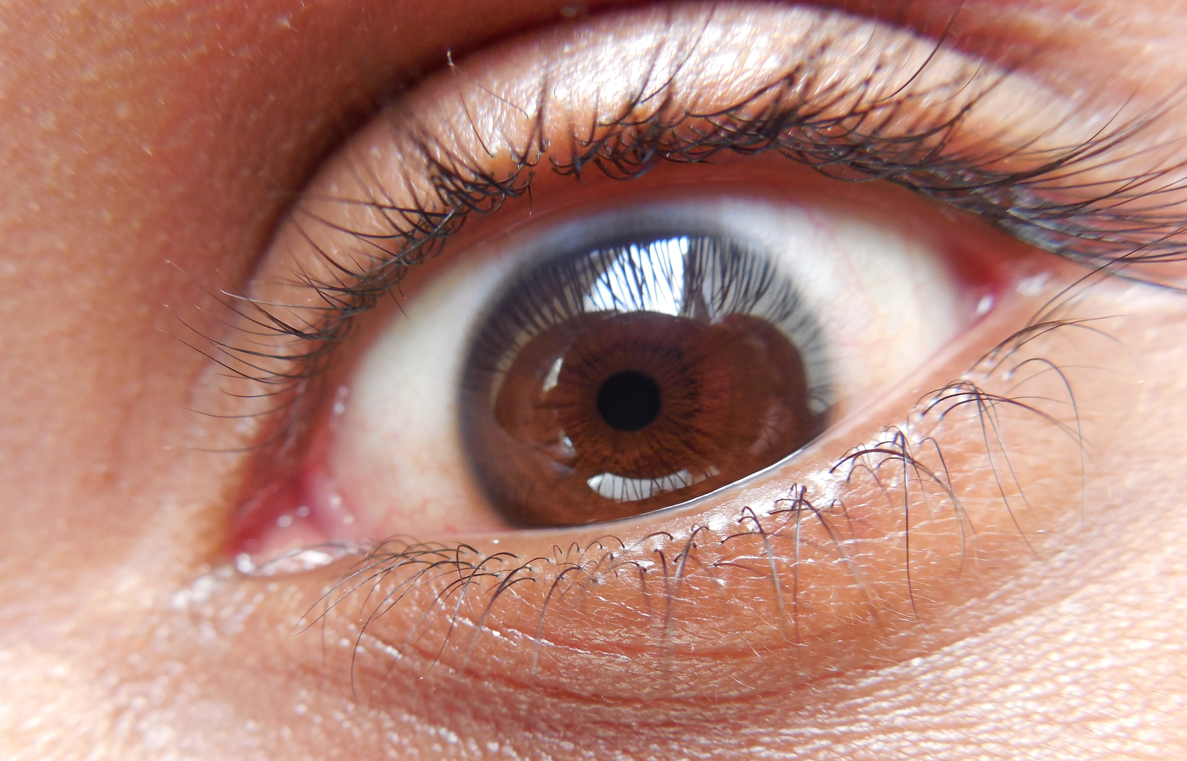 File:The human eye.JPG - Wikimedia Commons