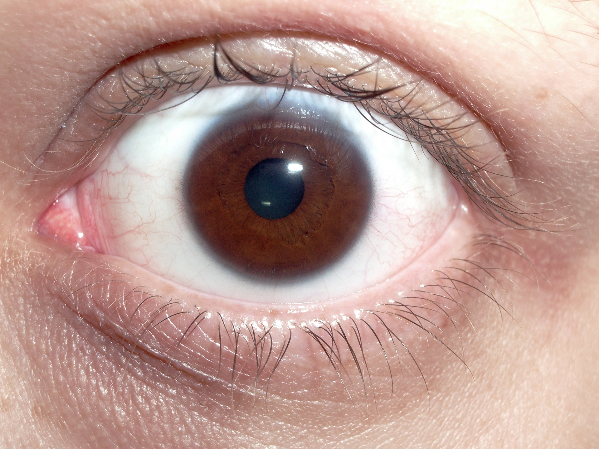 File:Brown human eye.jpg - Wikimedia Commons