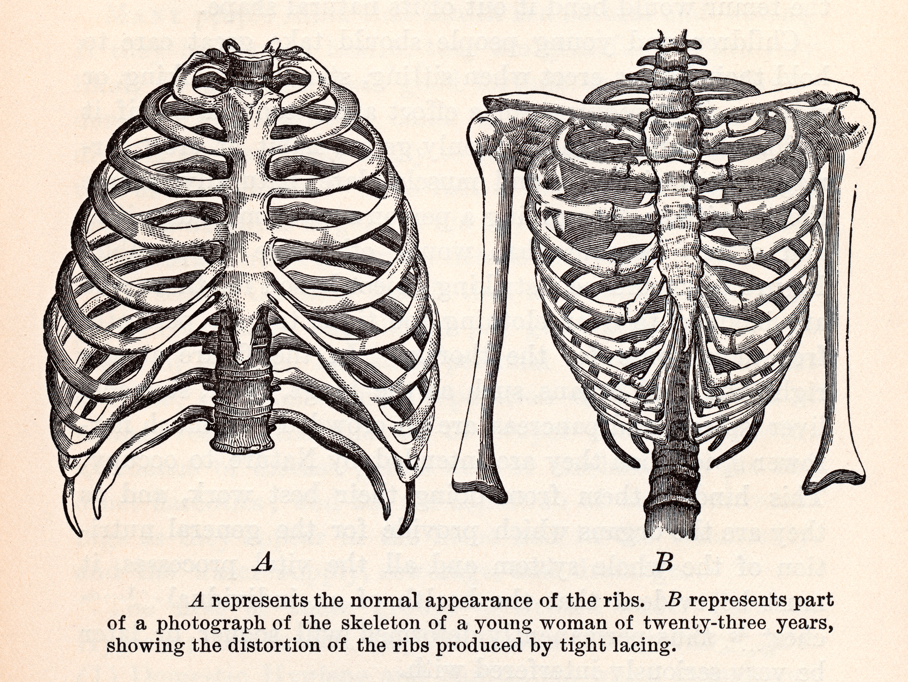 Human ribcages, circa 1911 photo