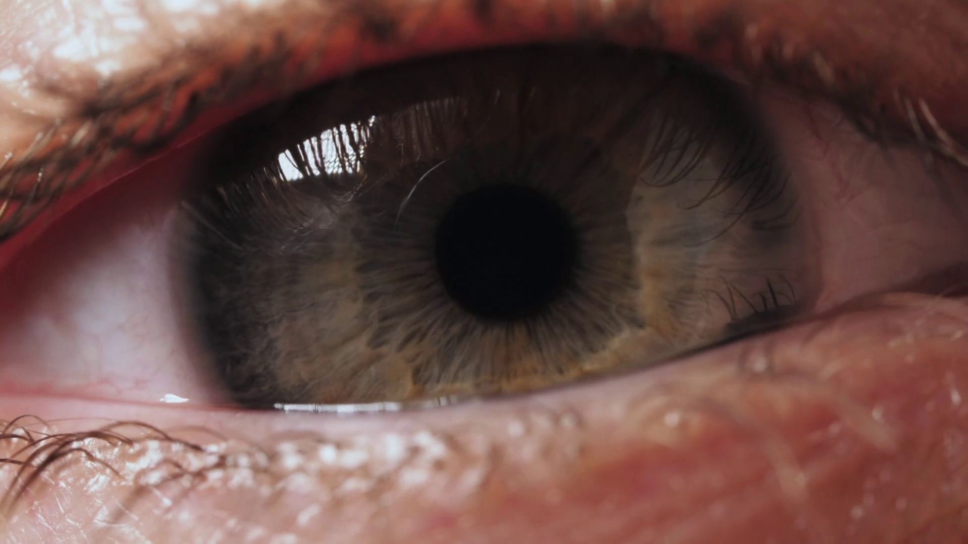 SLOW MOTION: Contraction of the pupil. Extreme close up human eye ...