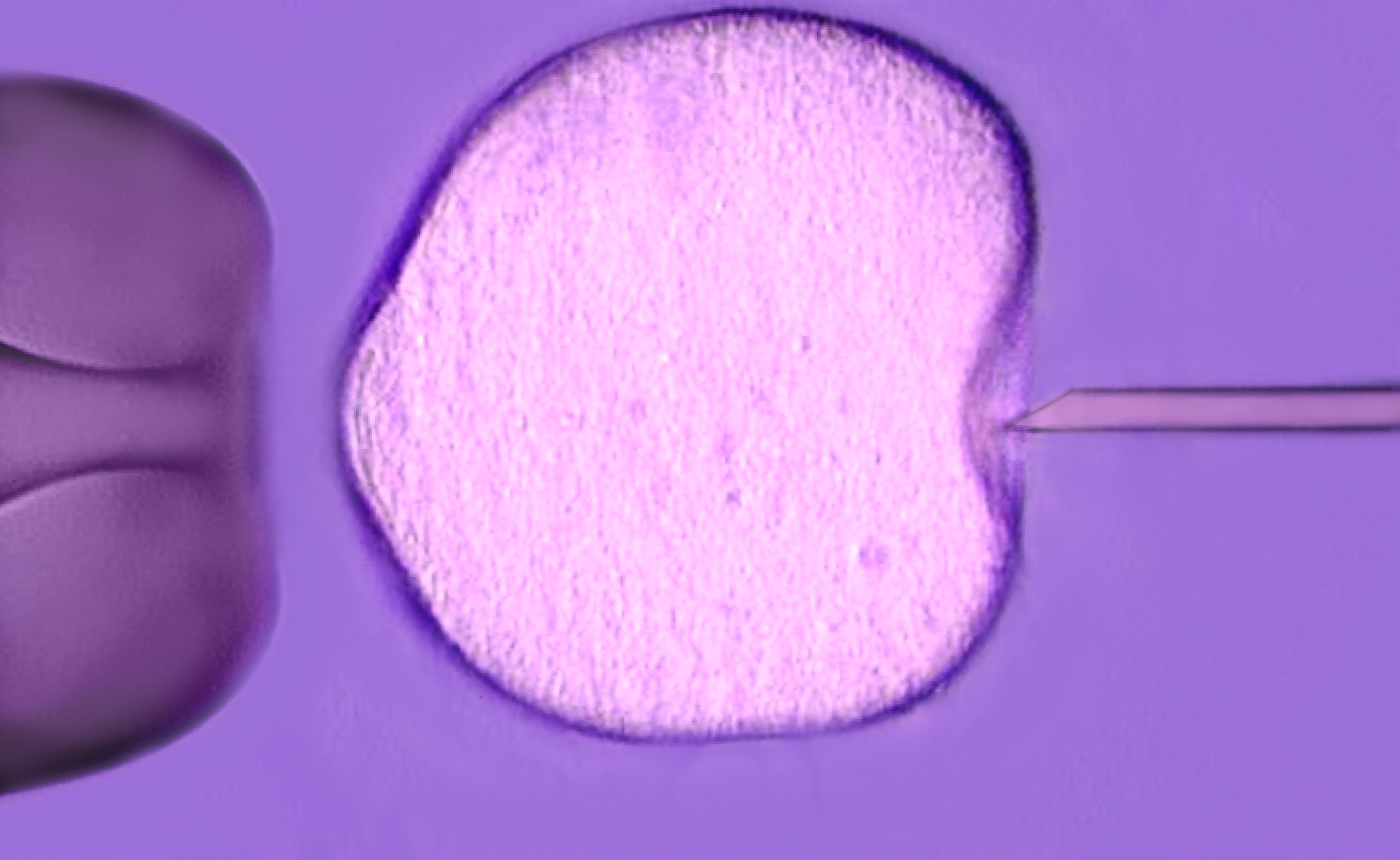 Ivf - in vitro fertilization microscopic photo