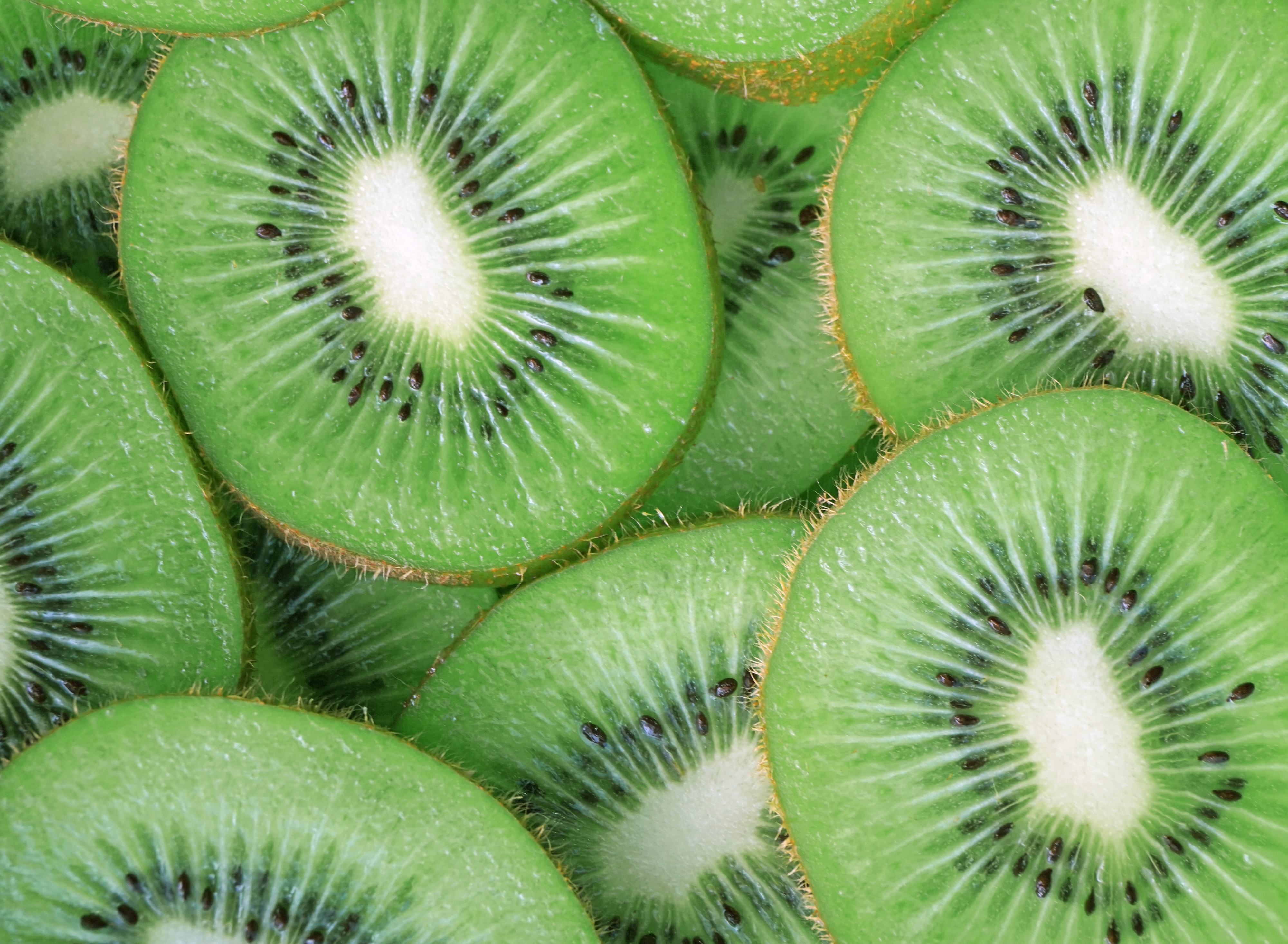 14 Healthy Reasons To Eat Kiwi | Care2 Healthy Living