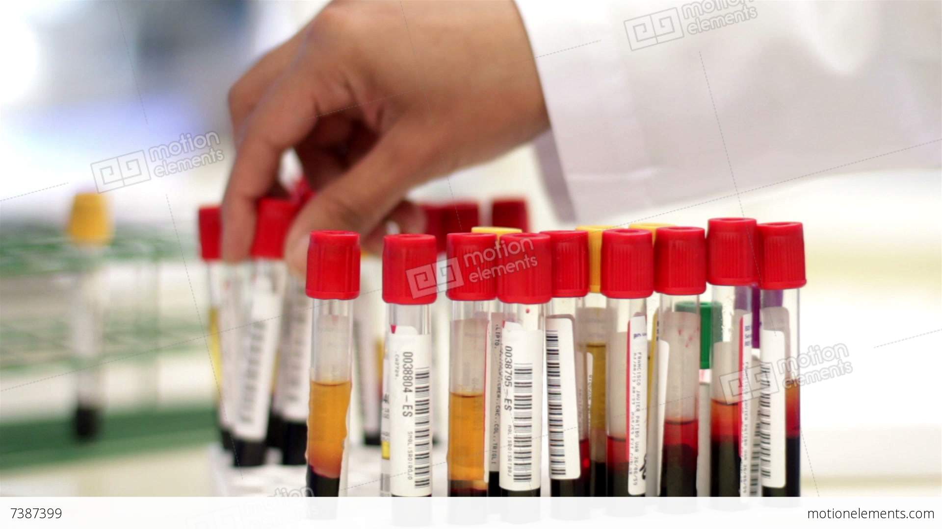 Blood Test Tubes Being Analyzed And Interchanged By A Laboratory ...
