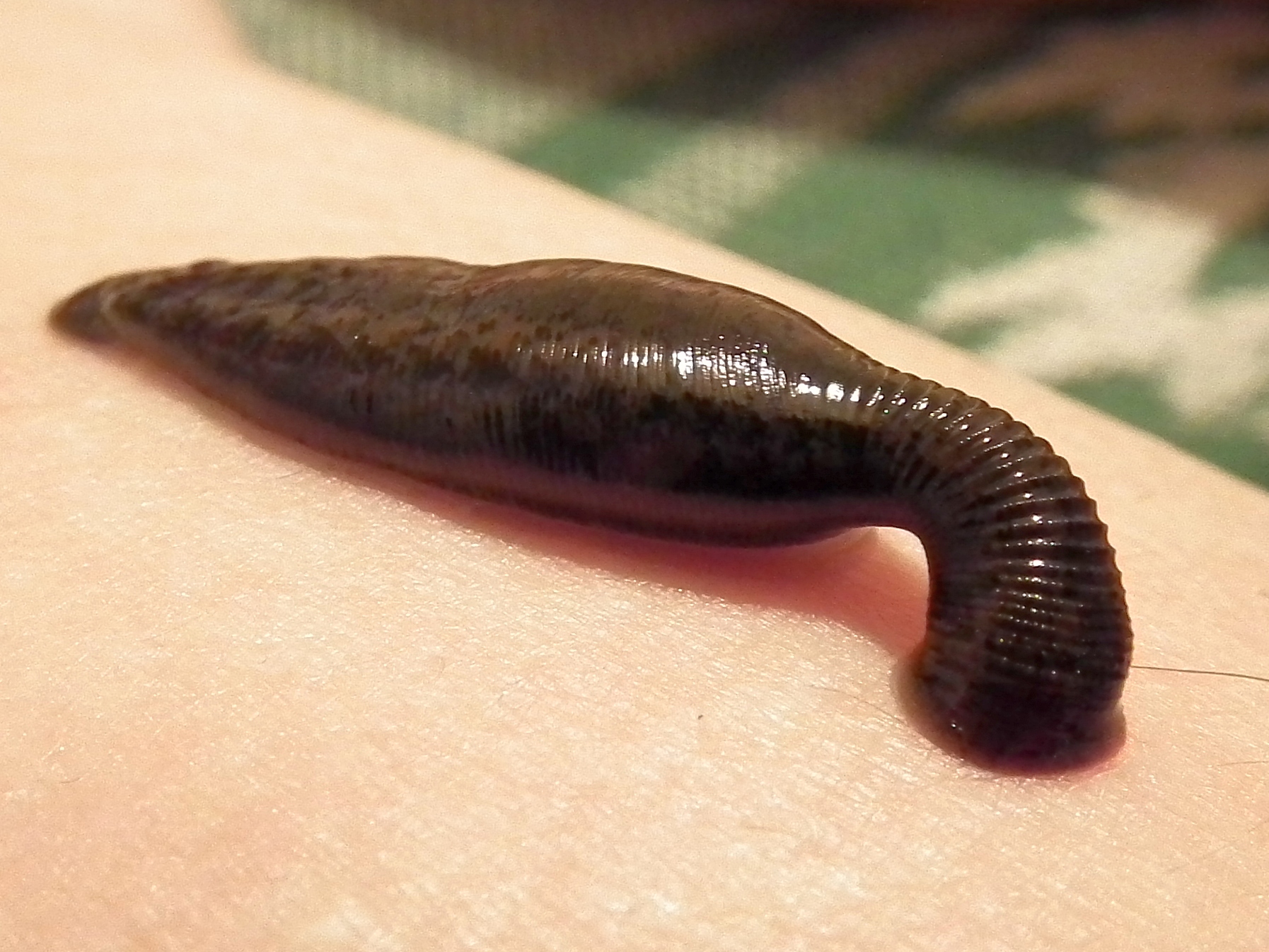 Where In the Body Have Leeches Been Found? Far Too Many Places ...