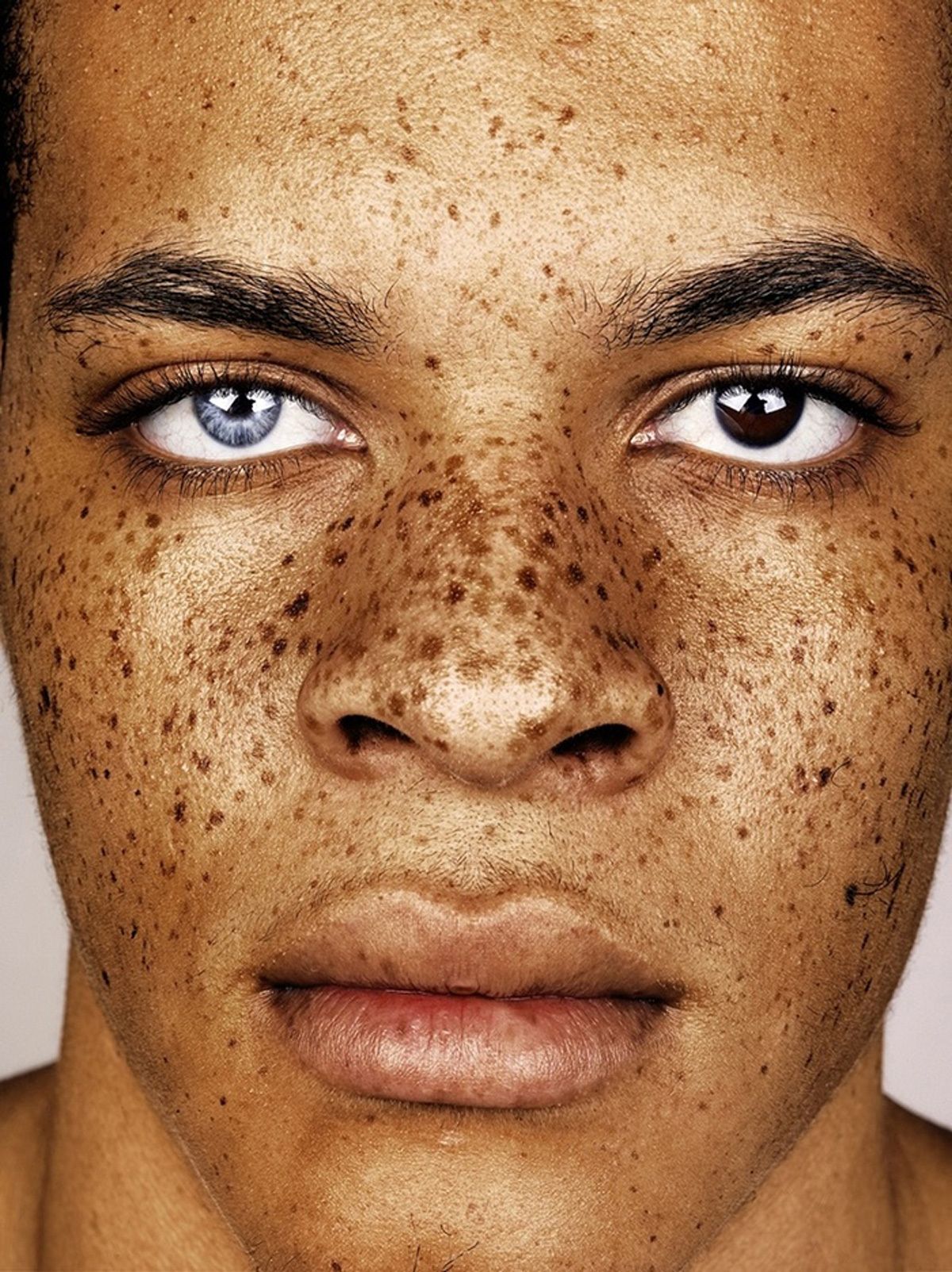 connecting the dots and finding beauty in freckles | Face, Eye and ...