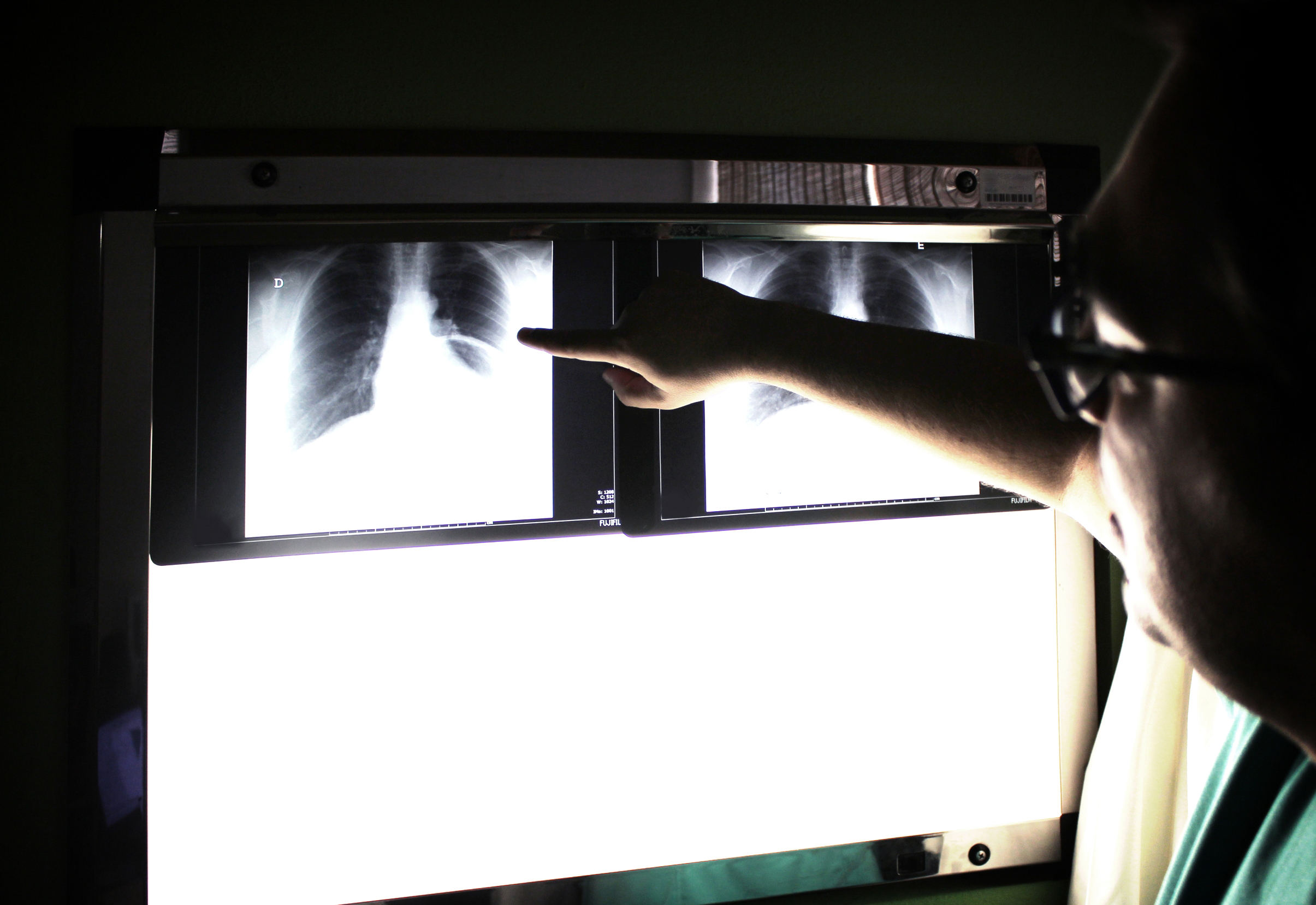 Medical doctor pointing to an x-ray image photo