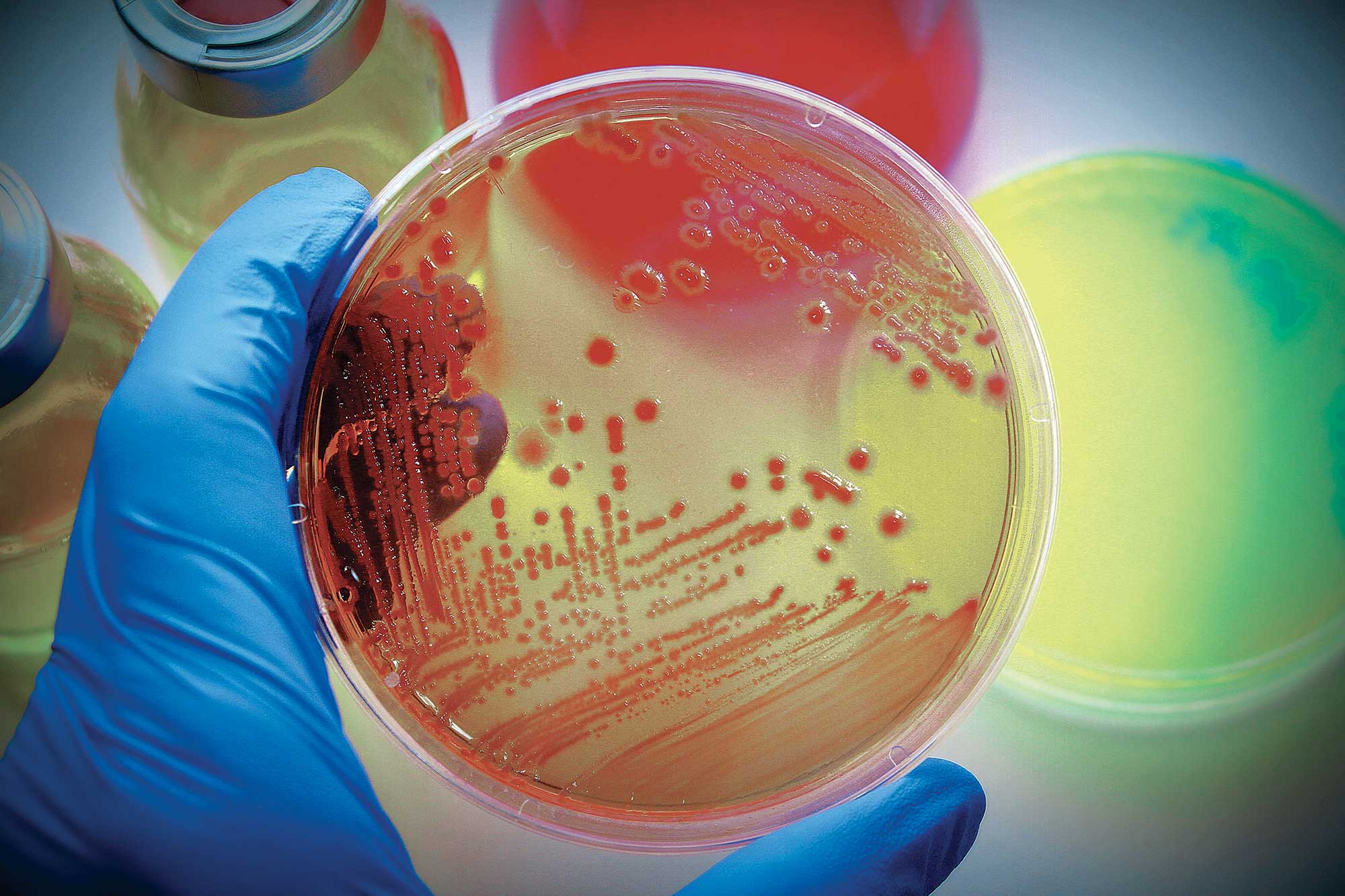 Microbiology photo