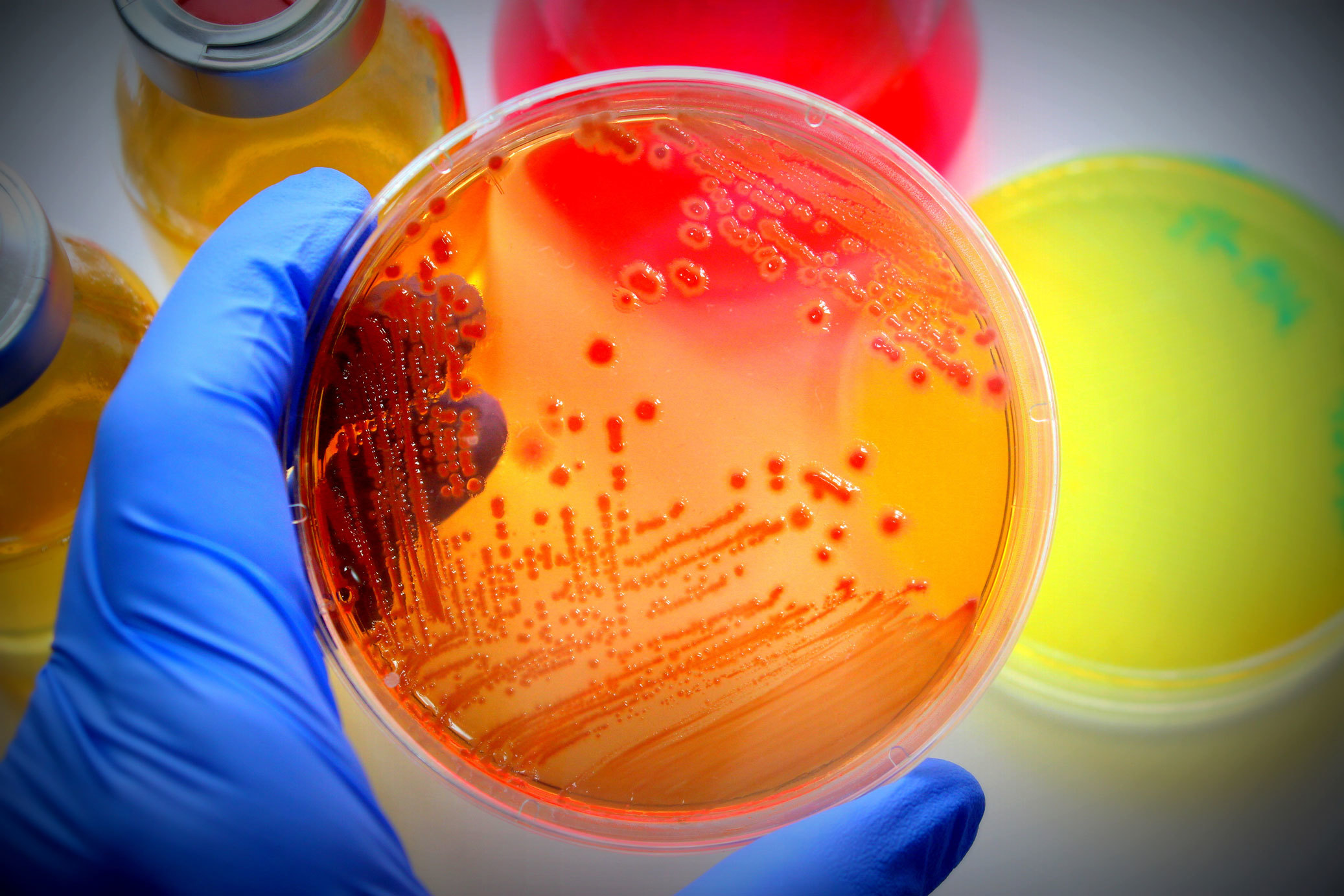 Microbiology - LiCa scientific