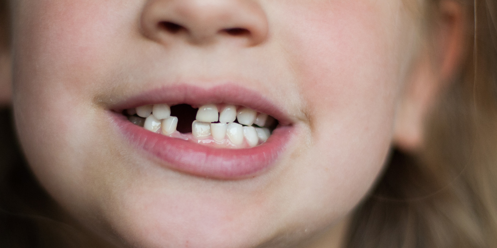 Детские зубы открытый рот