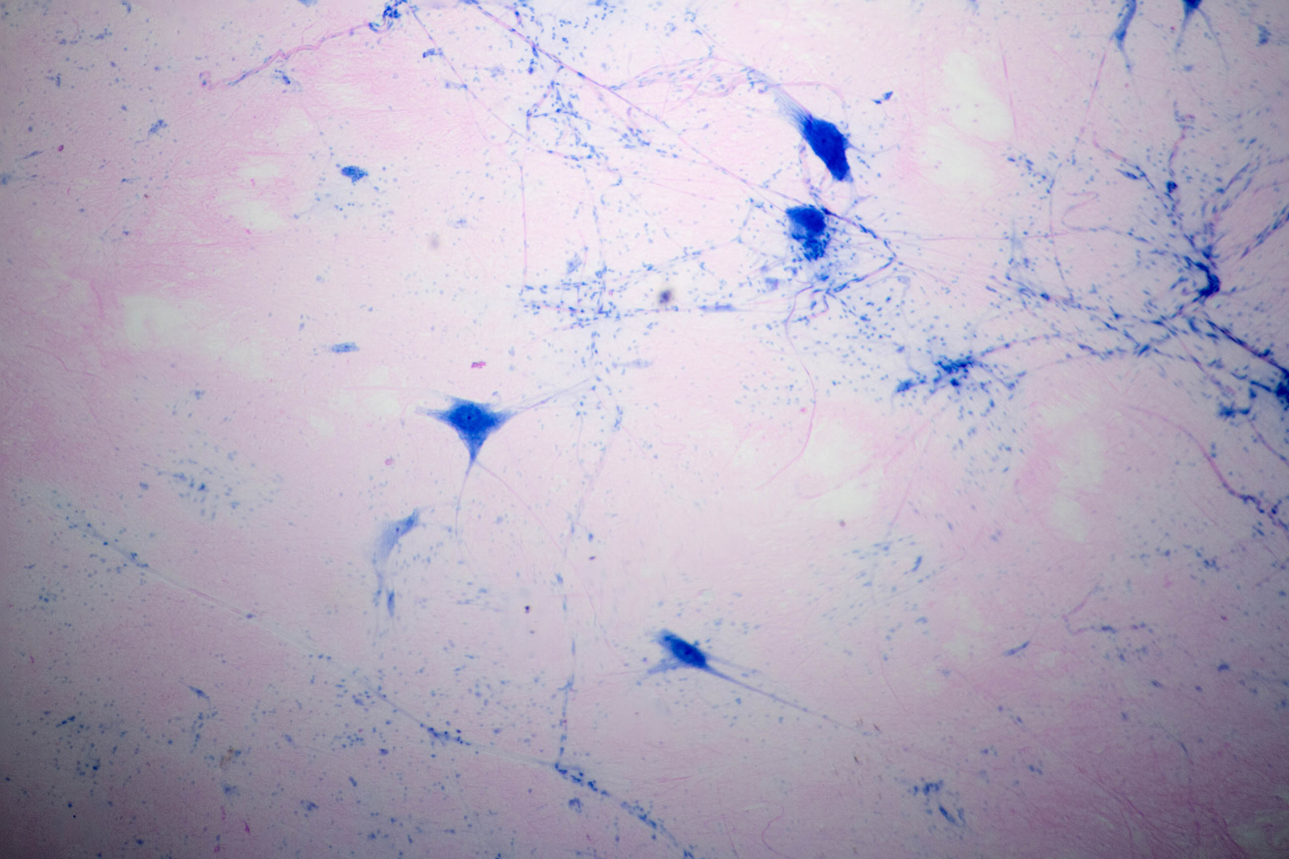 Multipolar neuron microscope view photo