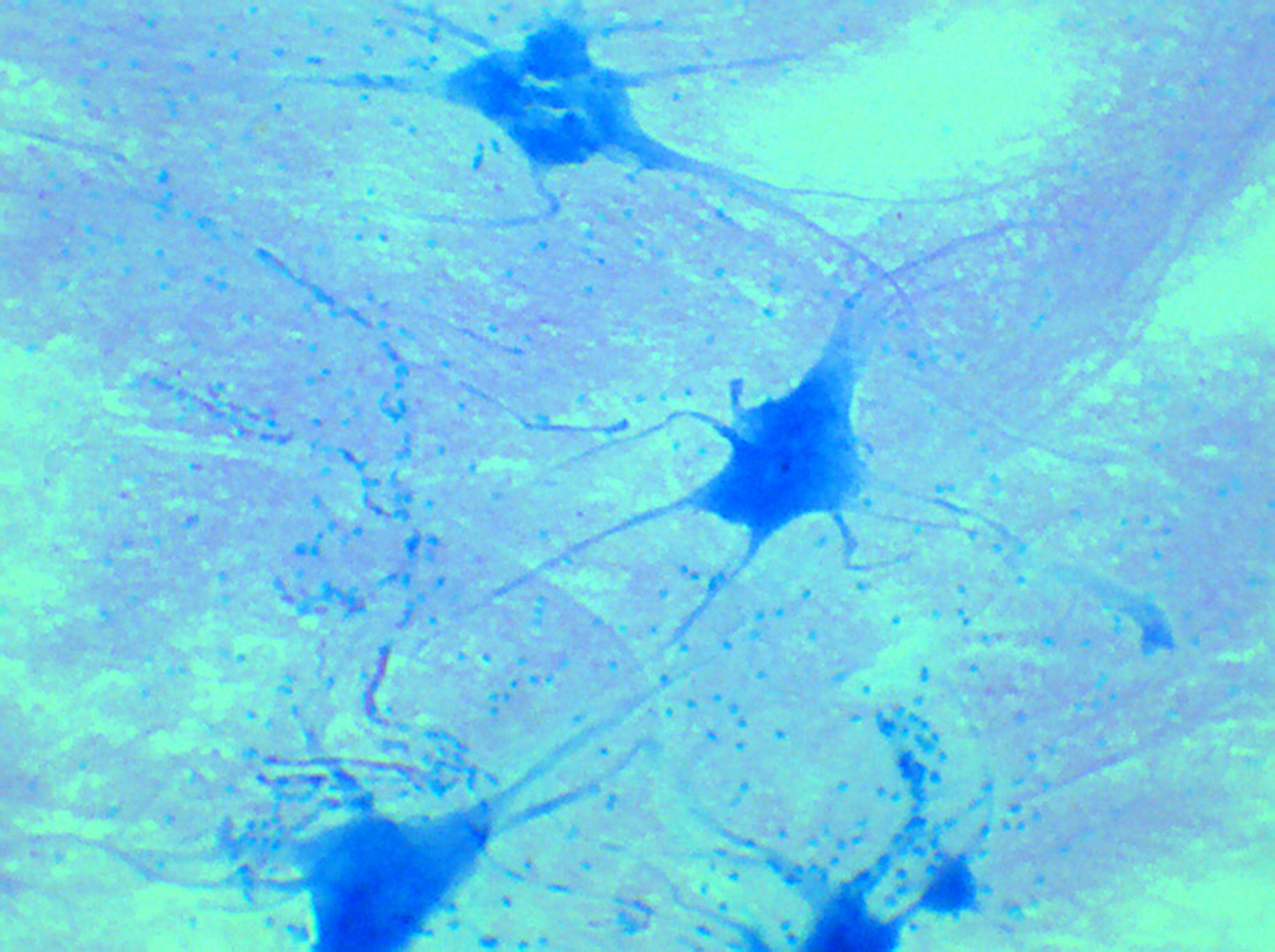 Giant Multipolar Neurons Smear Nerve Tissue (Neurons) 400x, Light ...