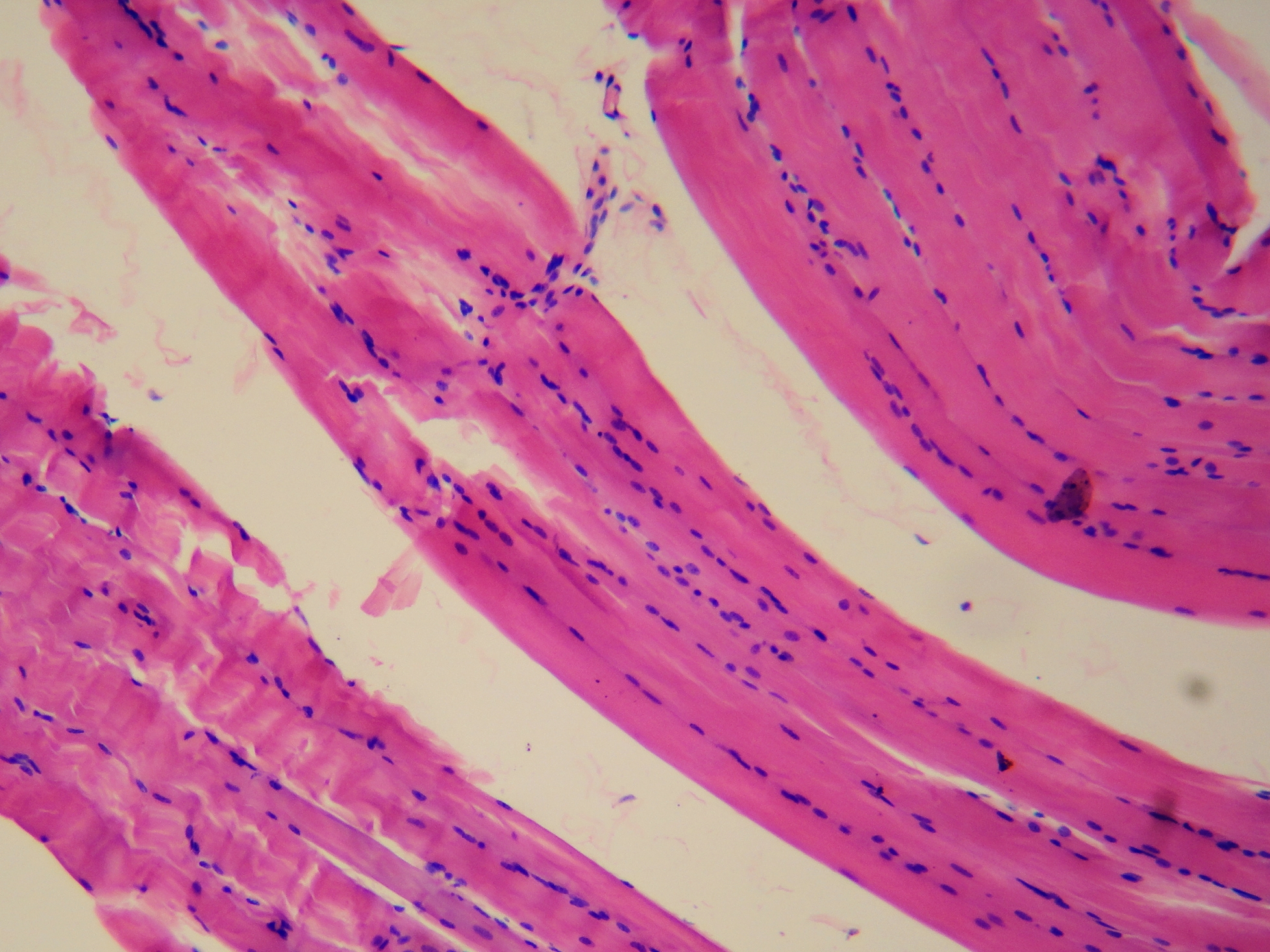File:Smooth muscle tissue.jpg - Wikimedia Commons
