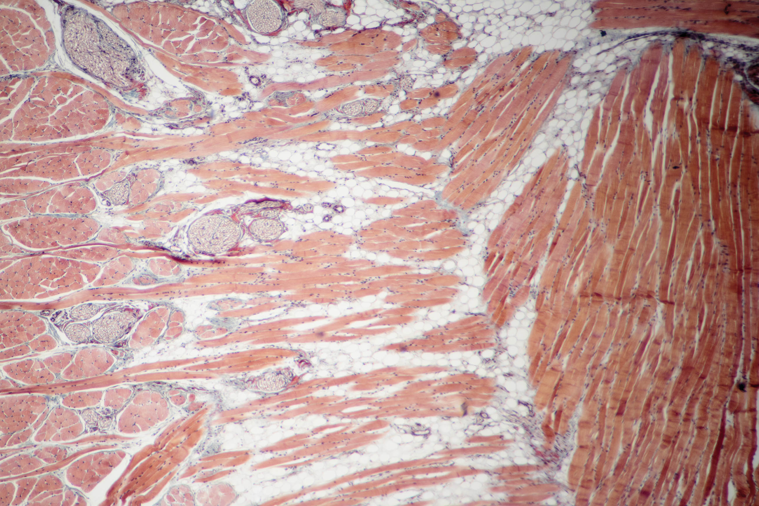 Muscle Tissue Texture, Anatomy, Microscopy, University, Tissue, HQ Photo