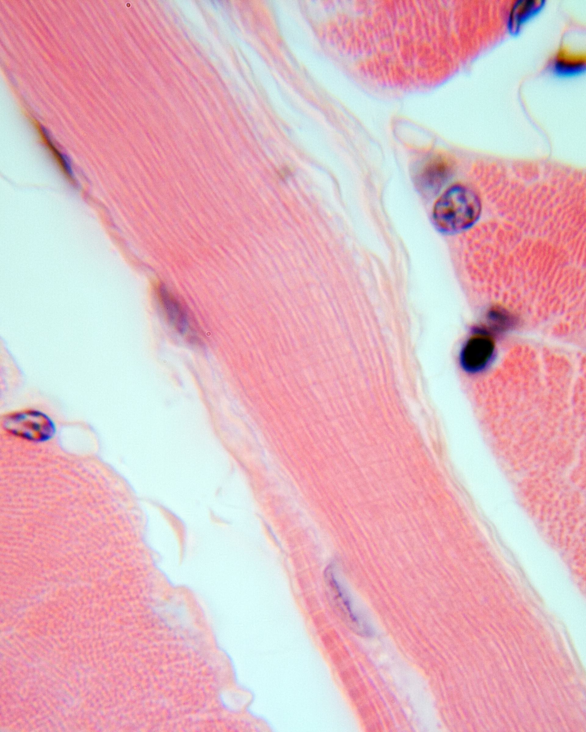 Muscle tissue photo