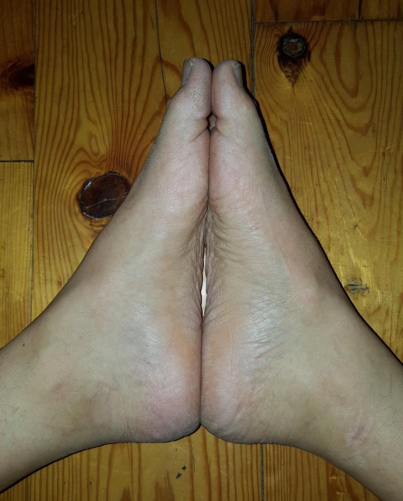 The Two Very Different Arches of My Feet