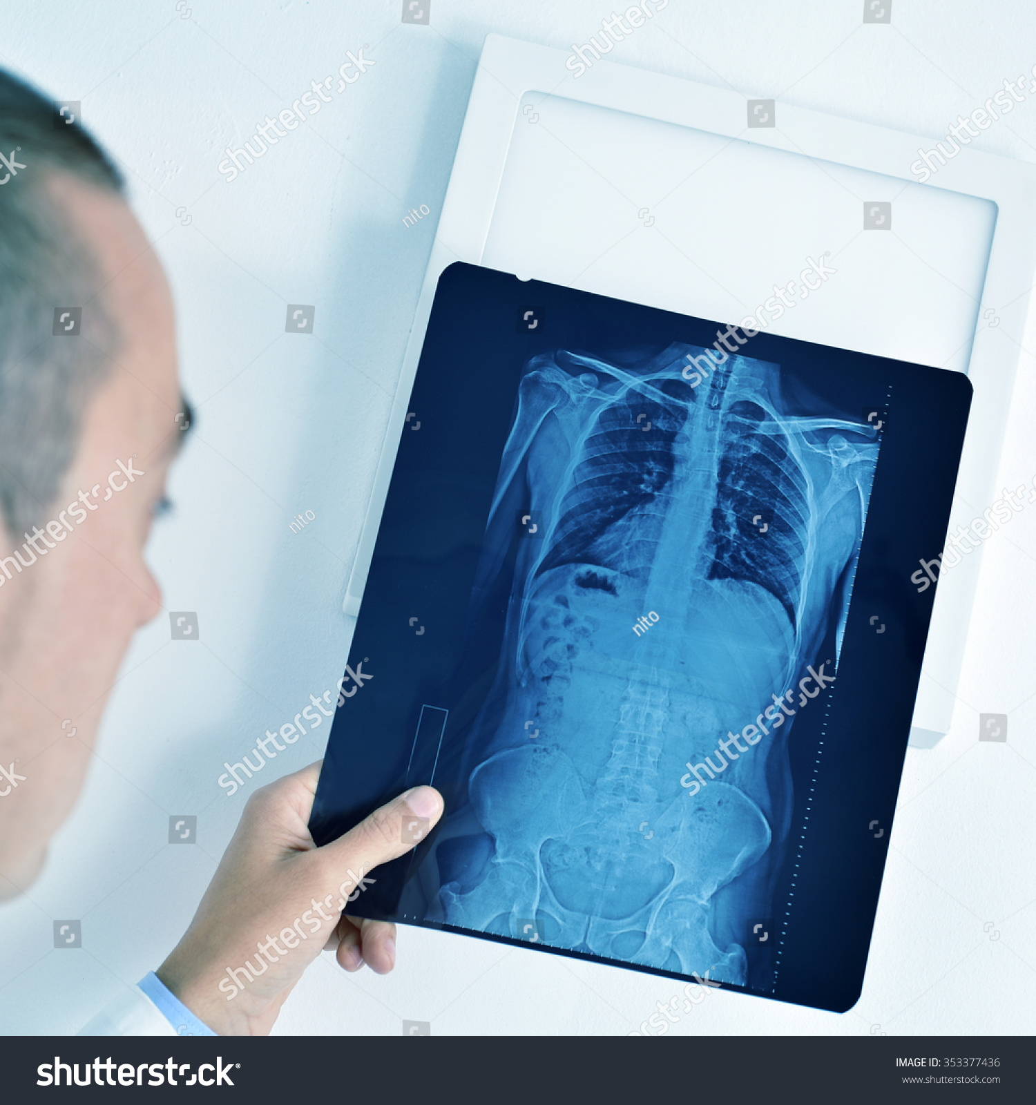 Closeup Young Caucasian Doctor Man Observing Stock Photo (Royalty ...