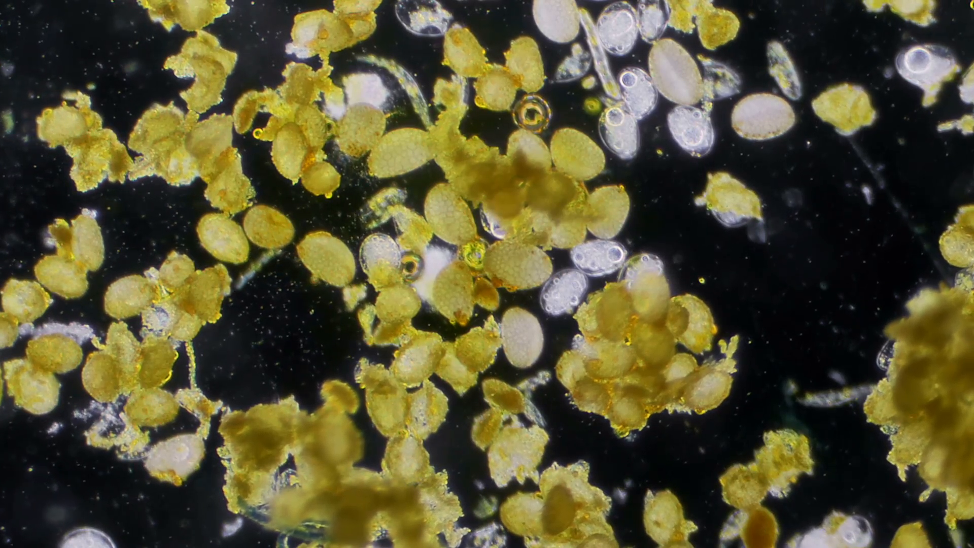 Flower Pollen Under Microscope Lily Flower Sample Stock Video ...